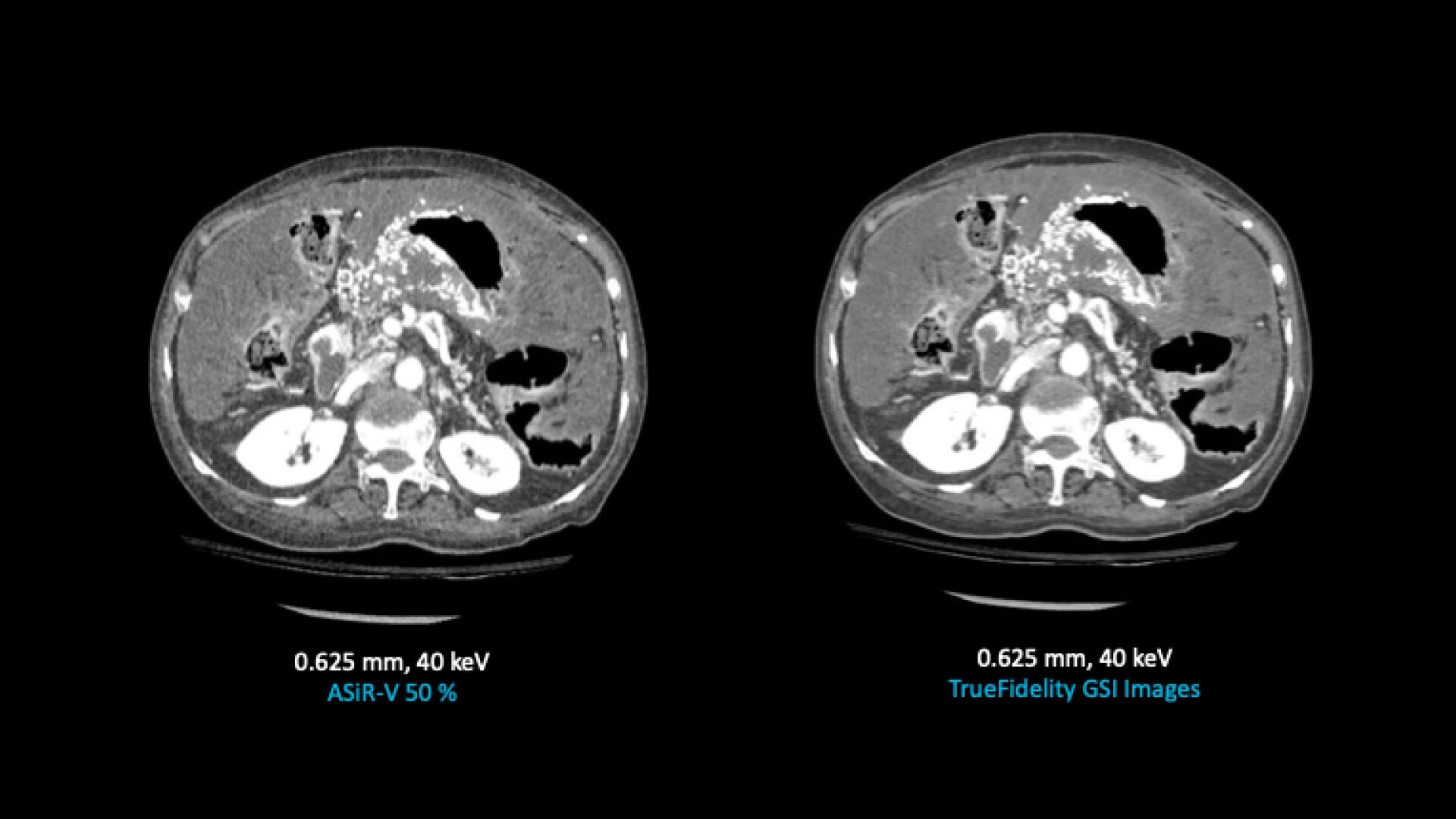Product Media Carousel Image