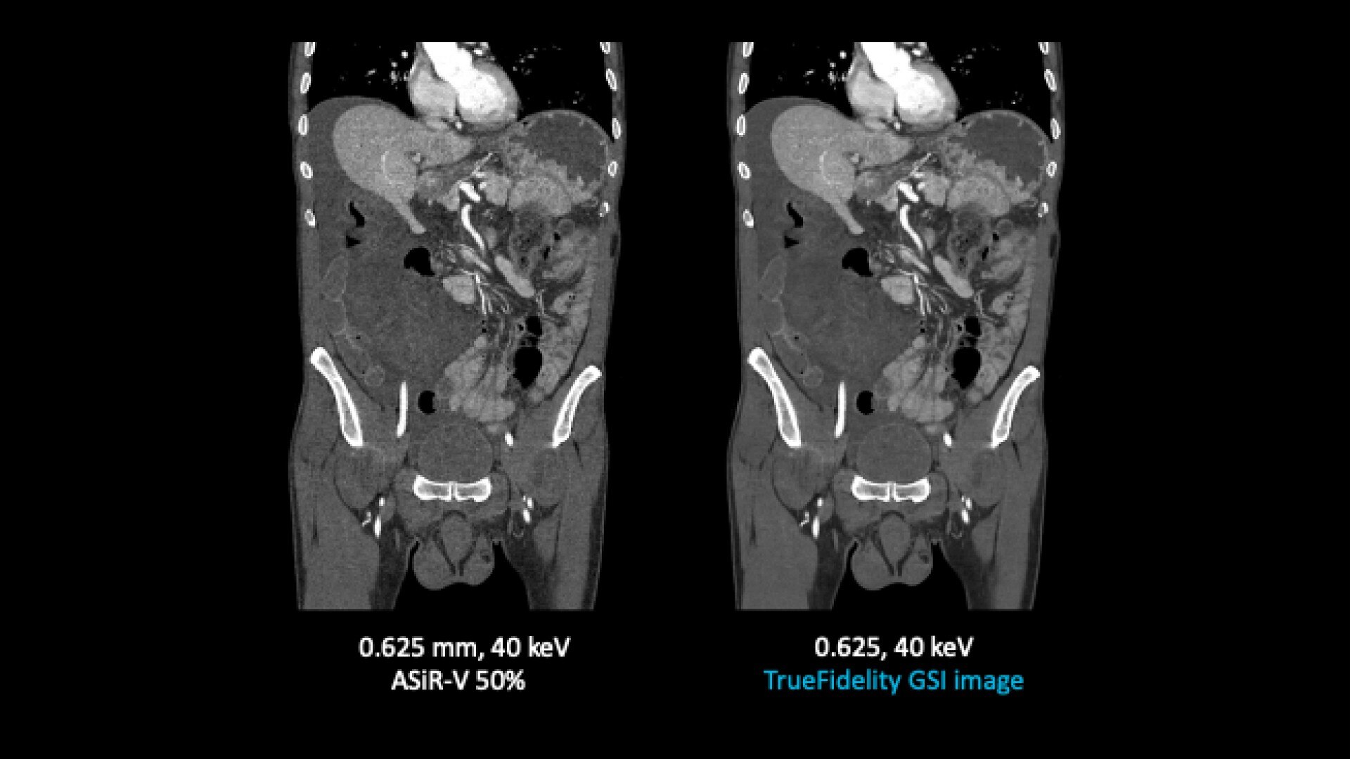 Product Media Carousel Image