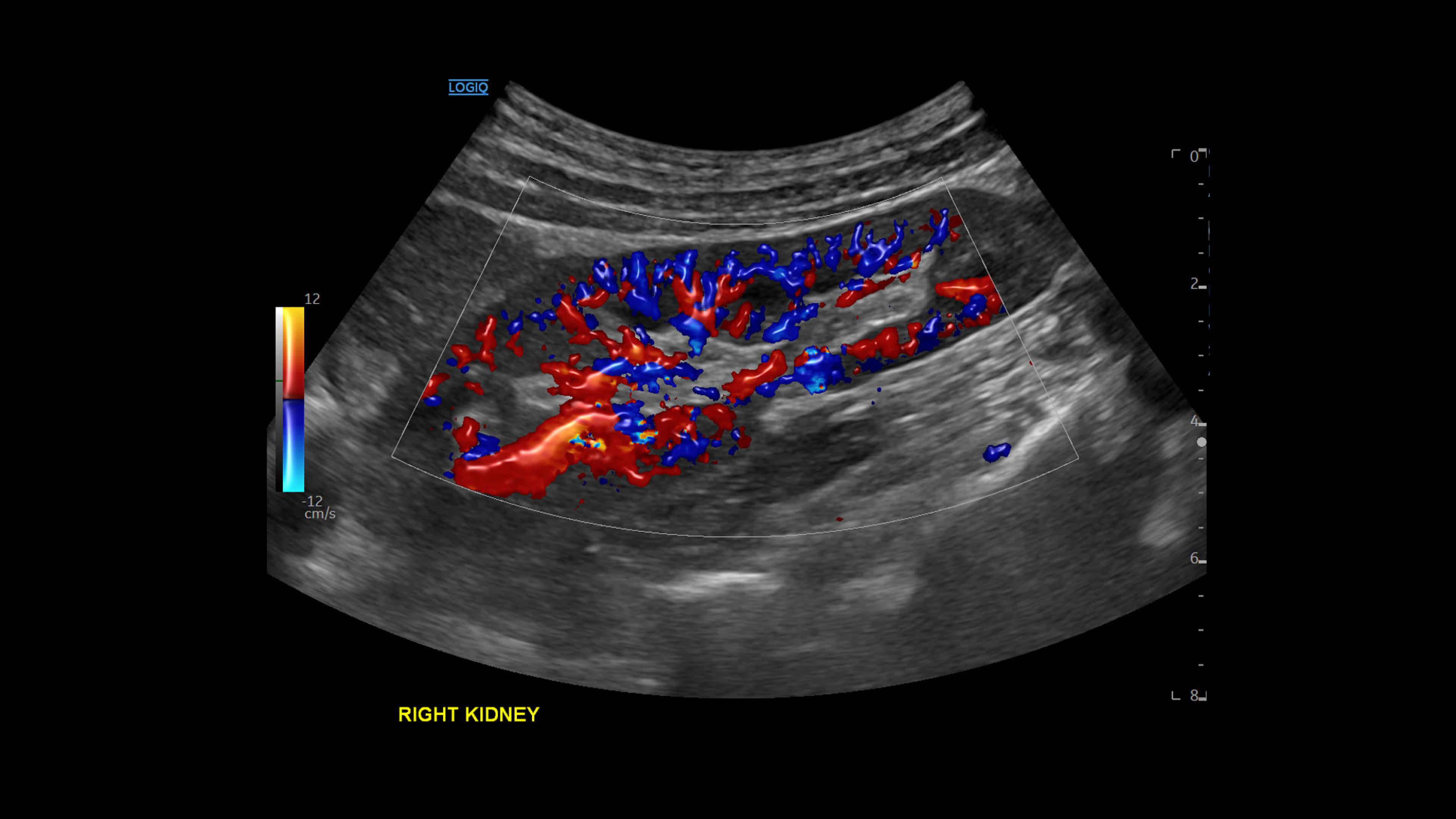 Product Media Carousel Image
