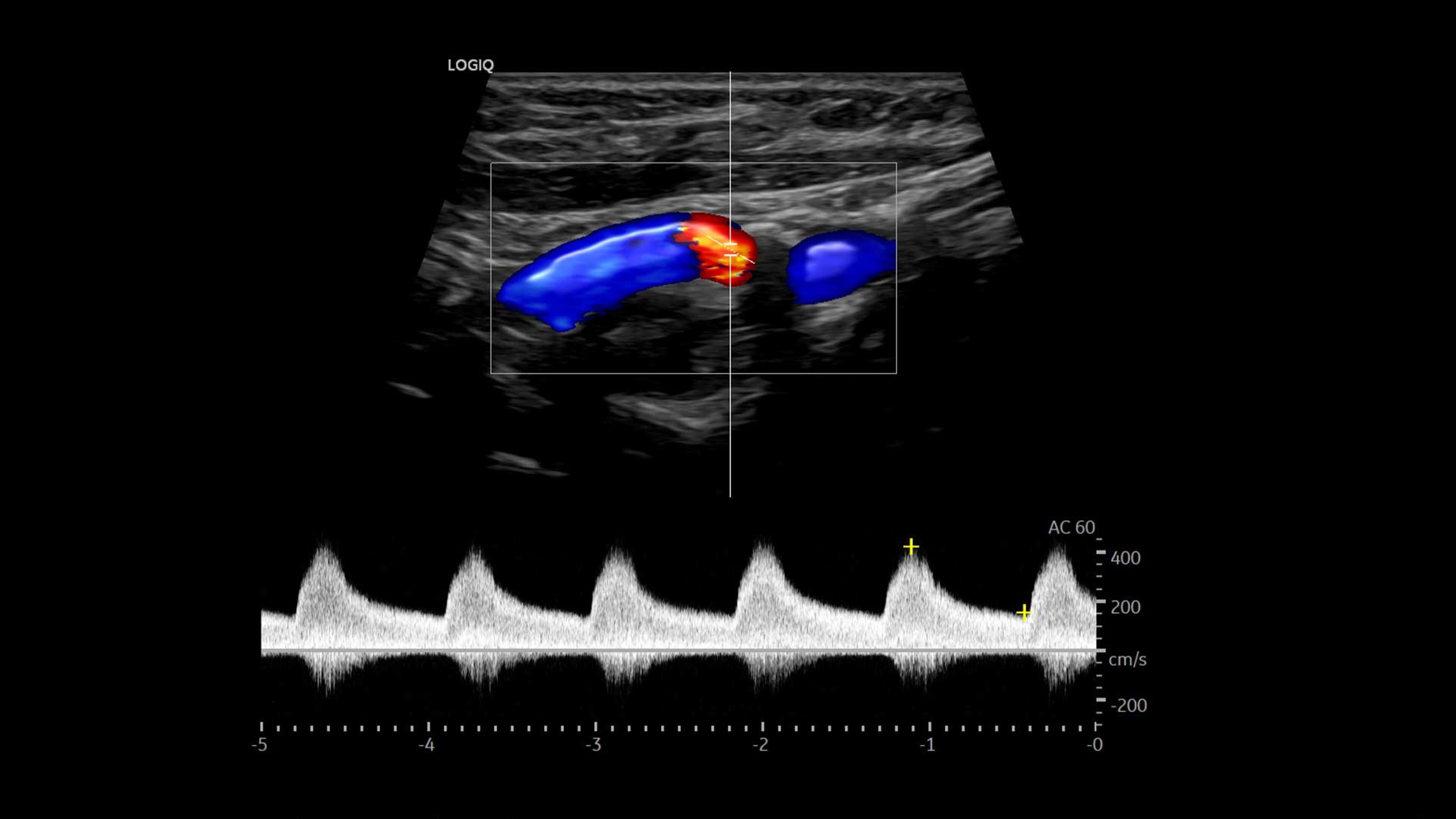 Product Media Carousel Image