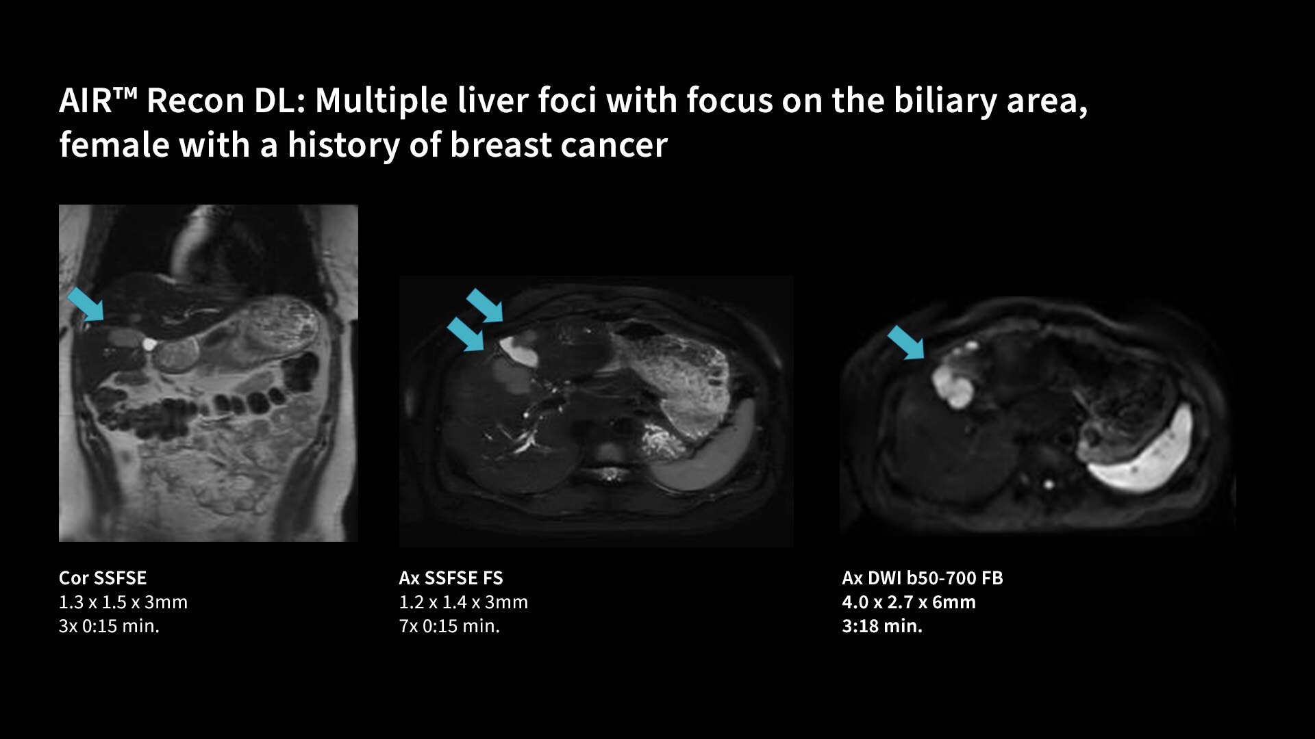 Product Media Carousel Image