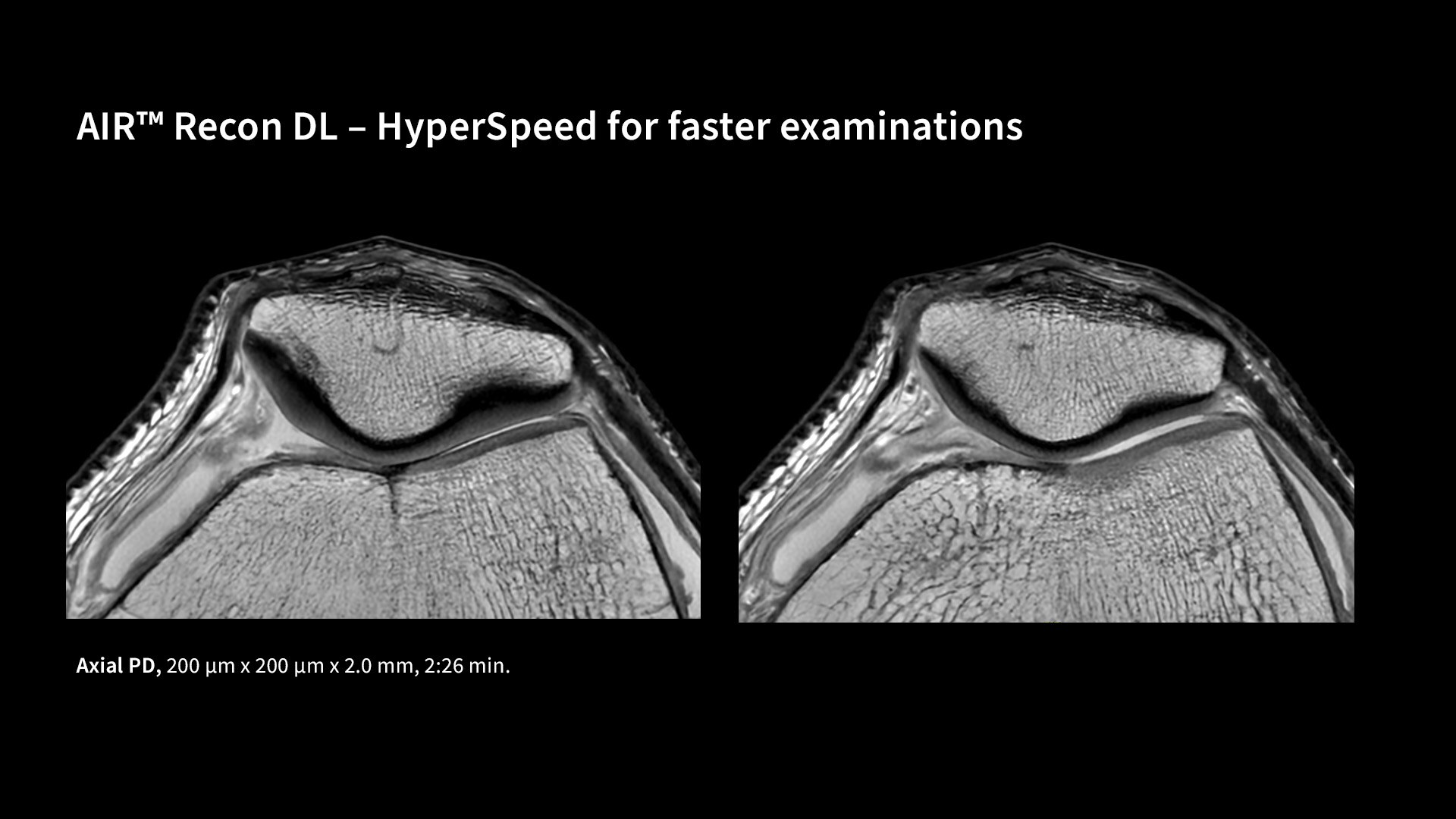 Product Media Carousel Image