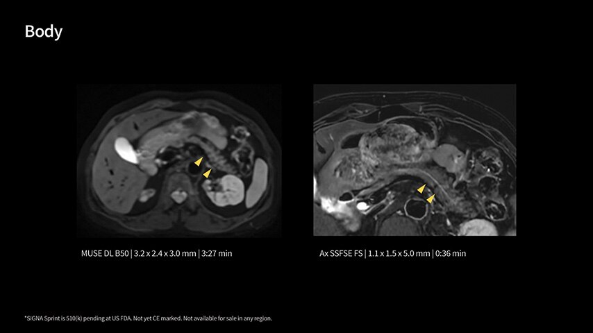 Product Media Carousel Image