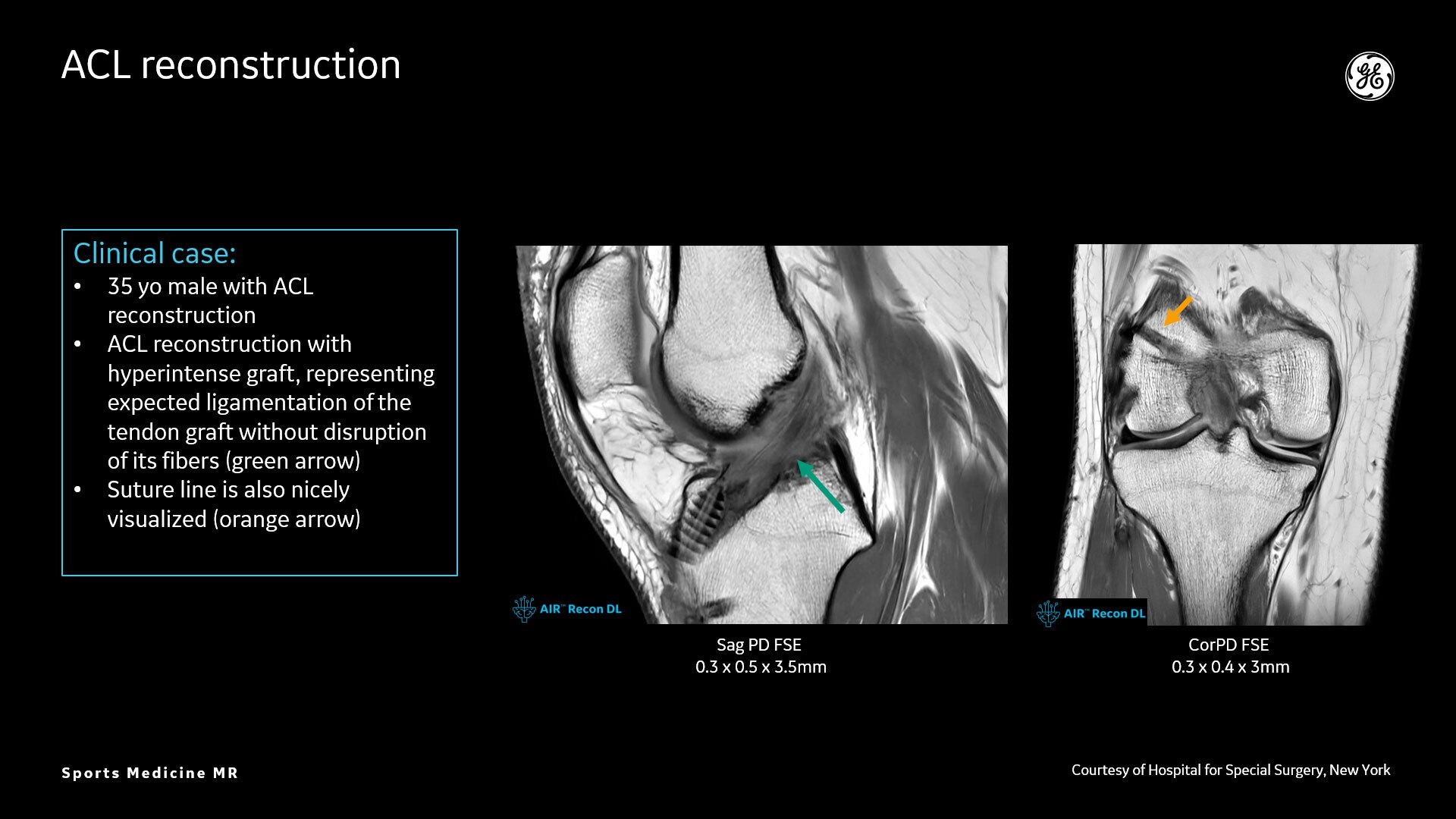 Product Media Carousel Image