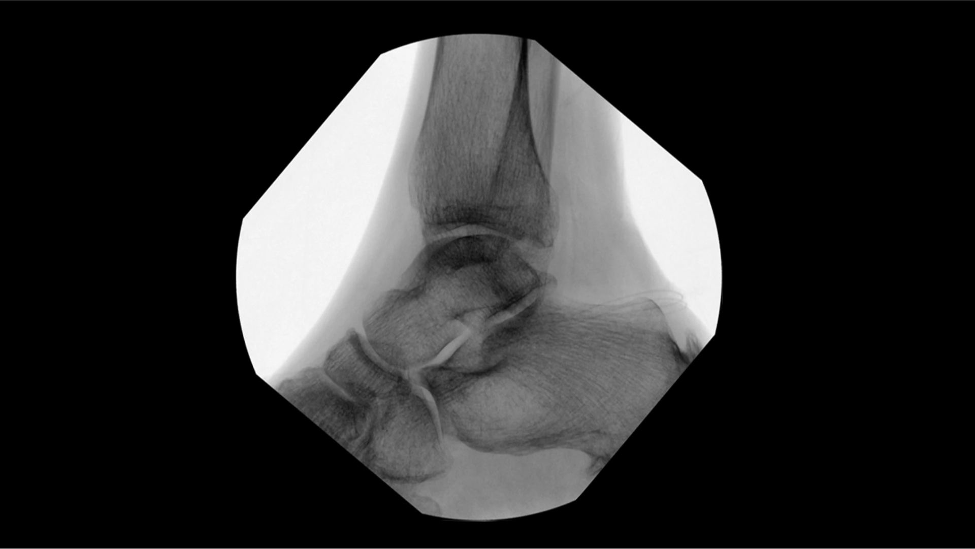 Product Media Carousel Image