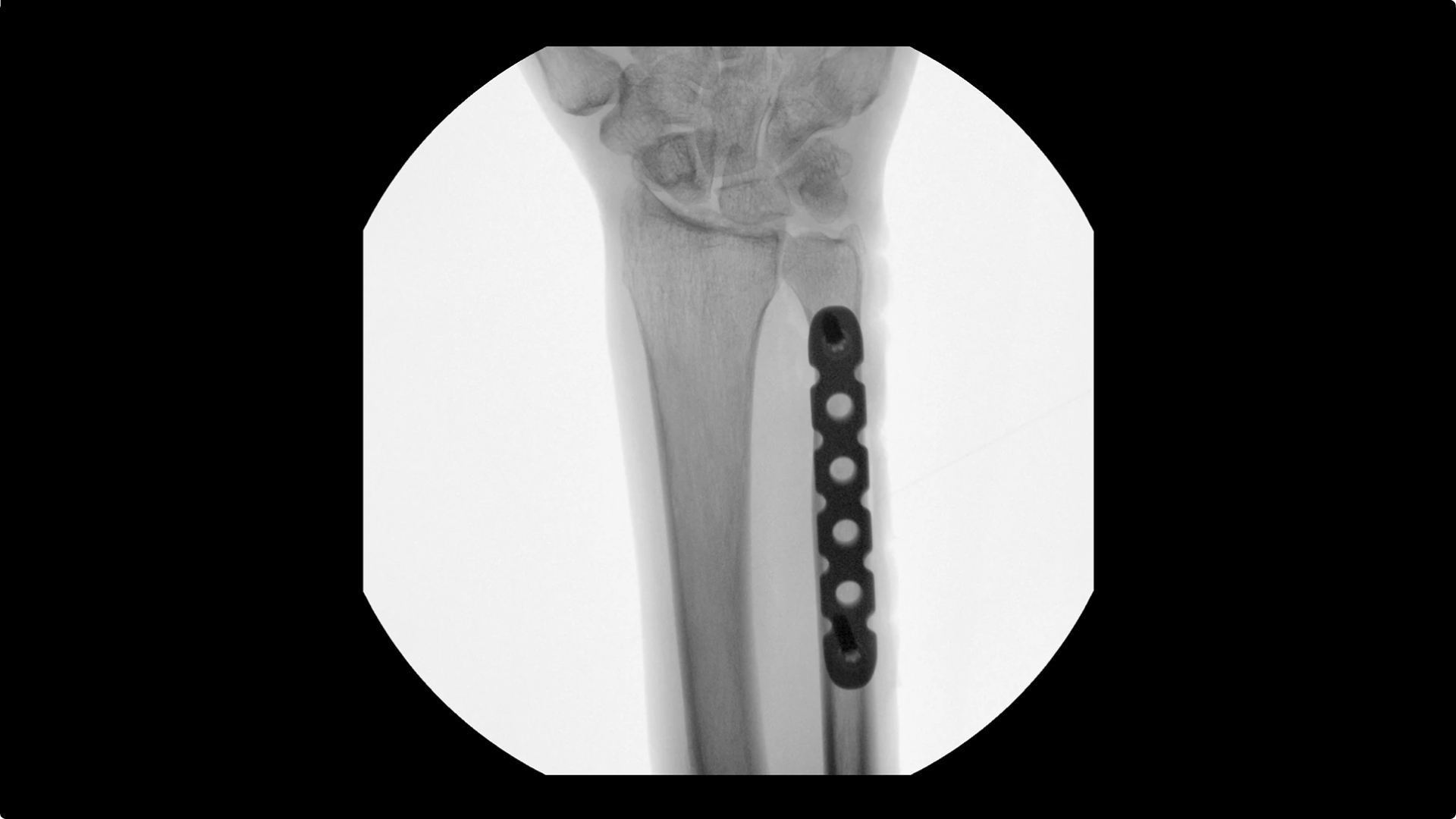 Product Media Carousel Image