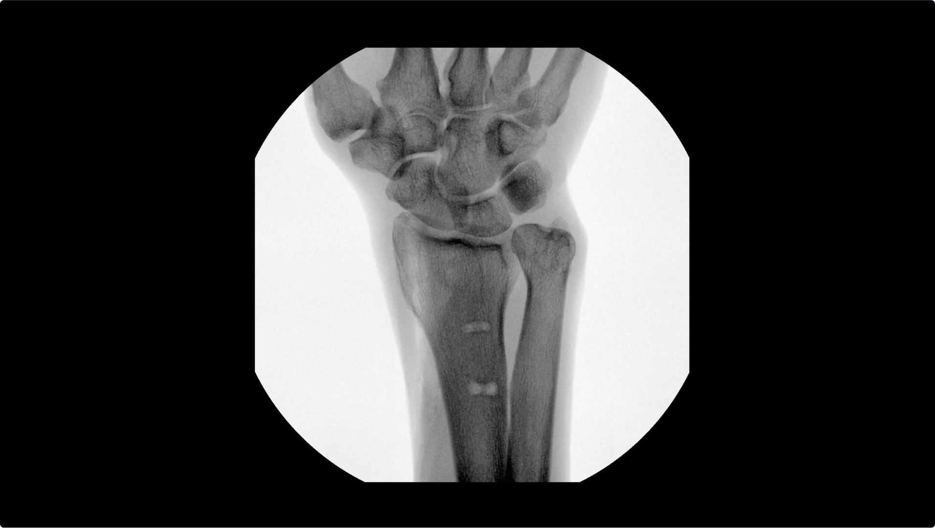 Product Media Carousel Image