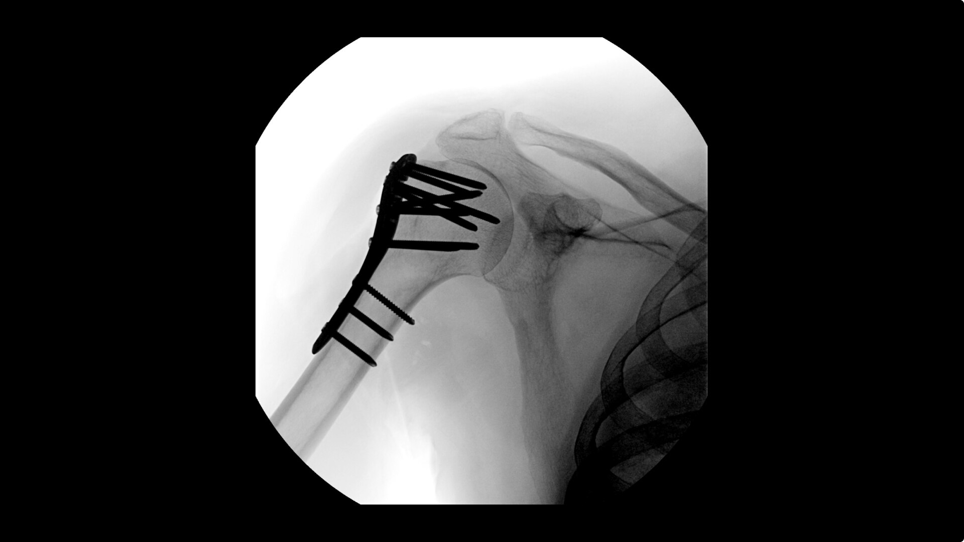 Product Media Carousel Image