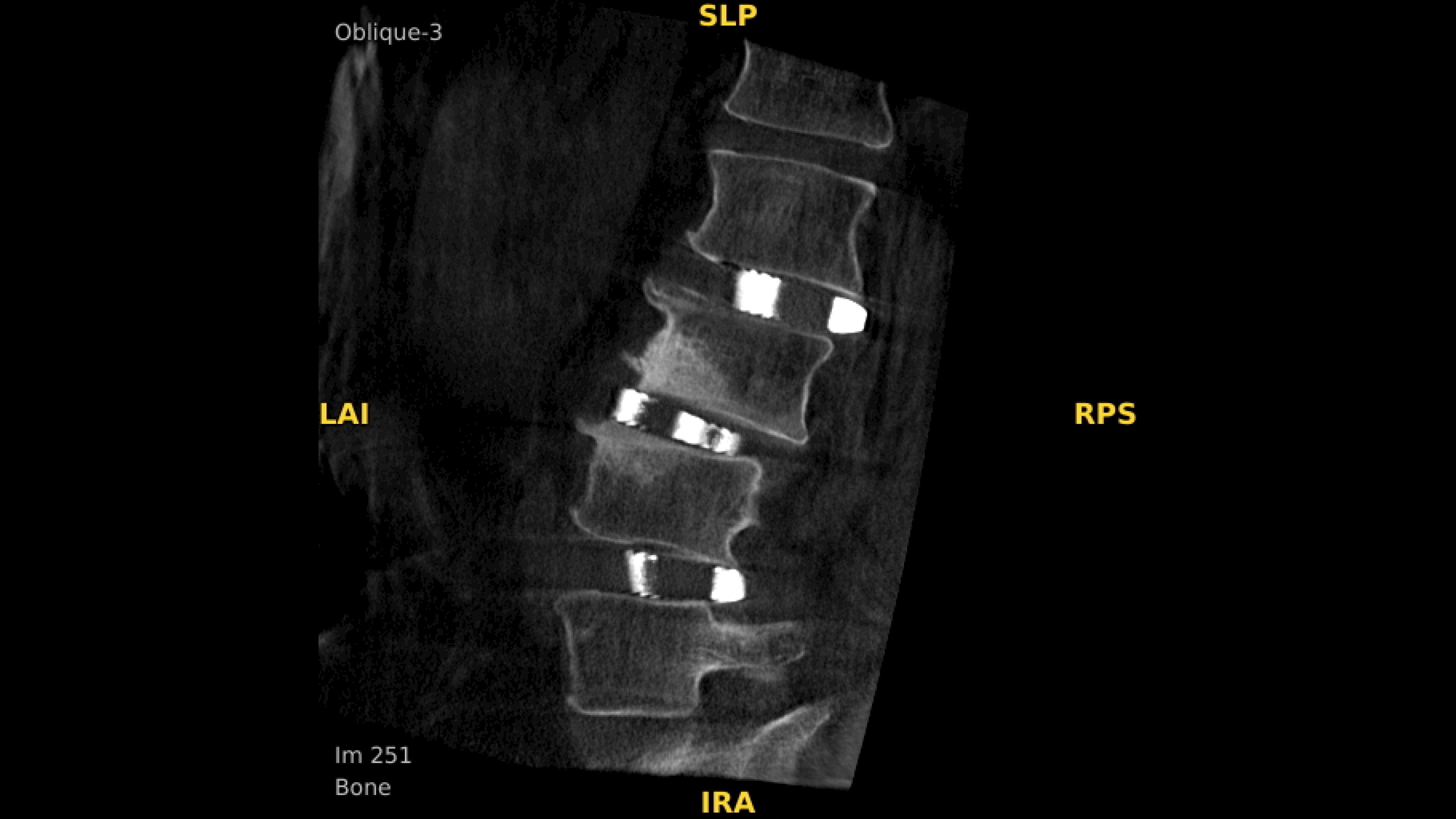 Product Media Carousel Image