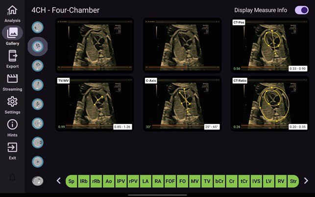 Product Media Carousel Image