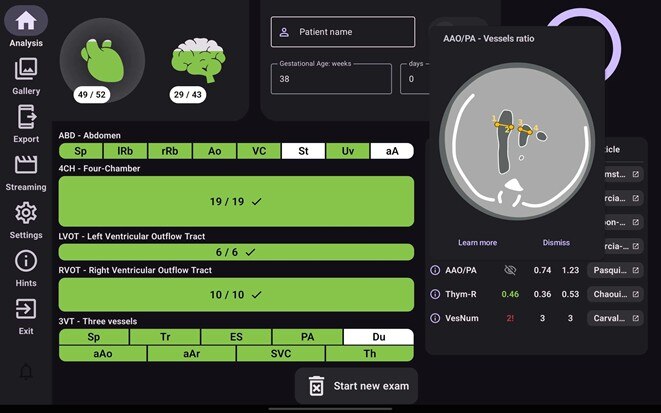 Product Media Carousel Image