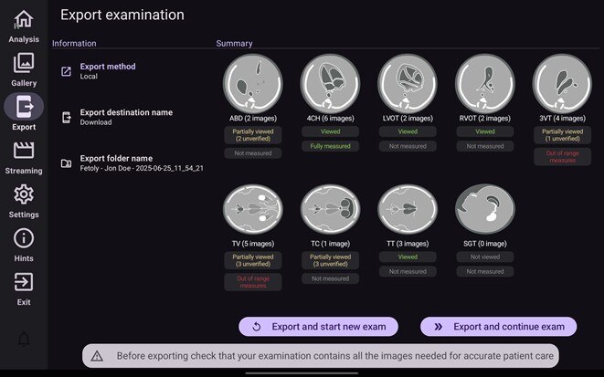 Product Media Carousel Image