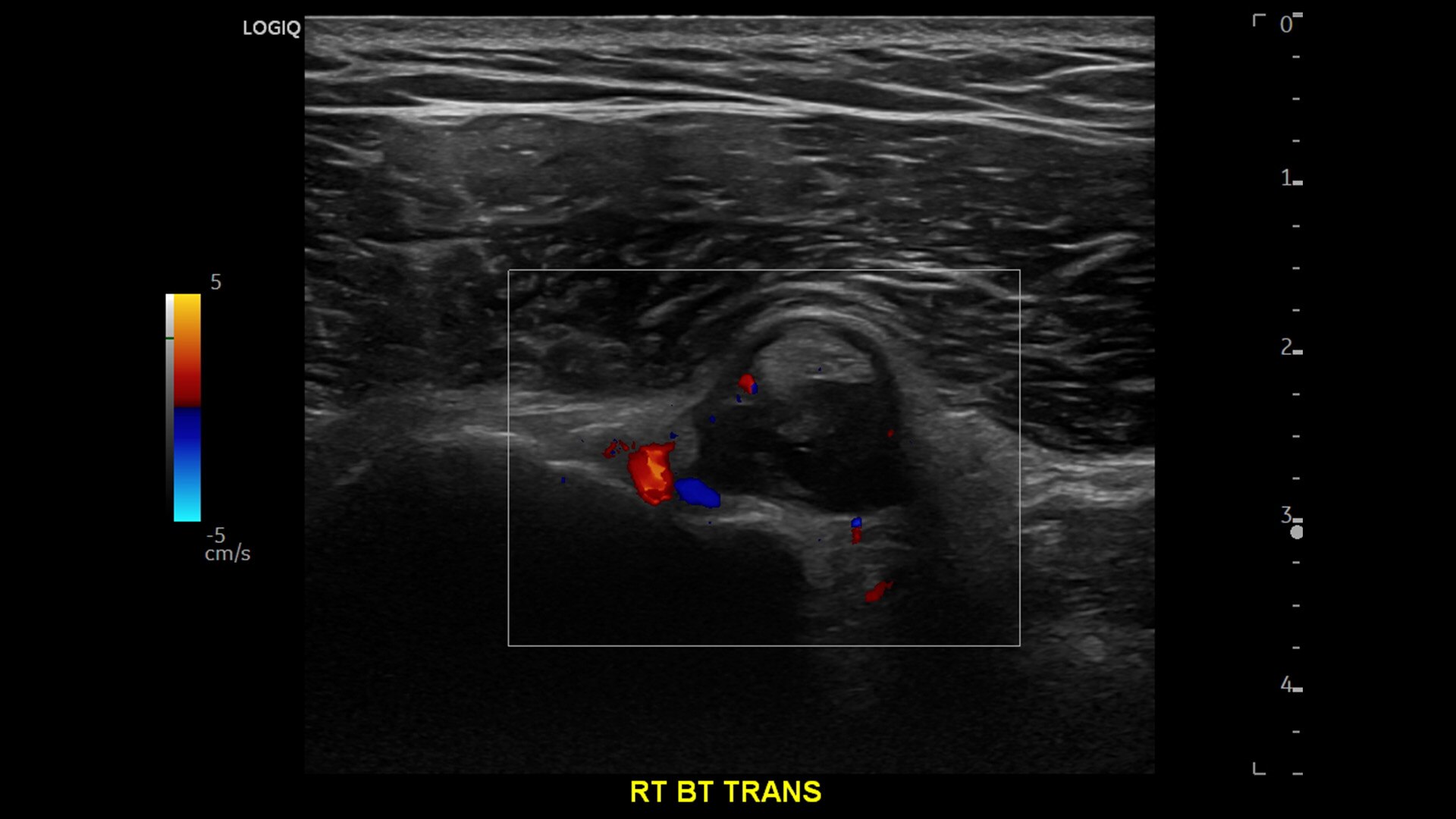 Product Media Carousel Image