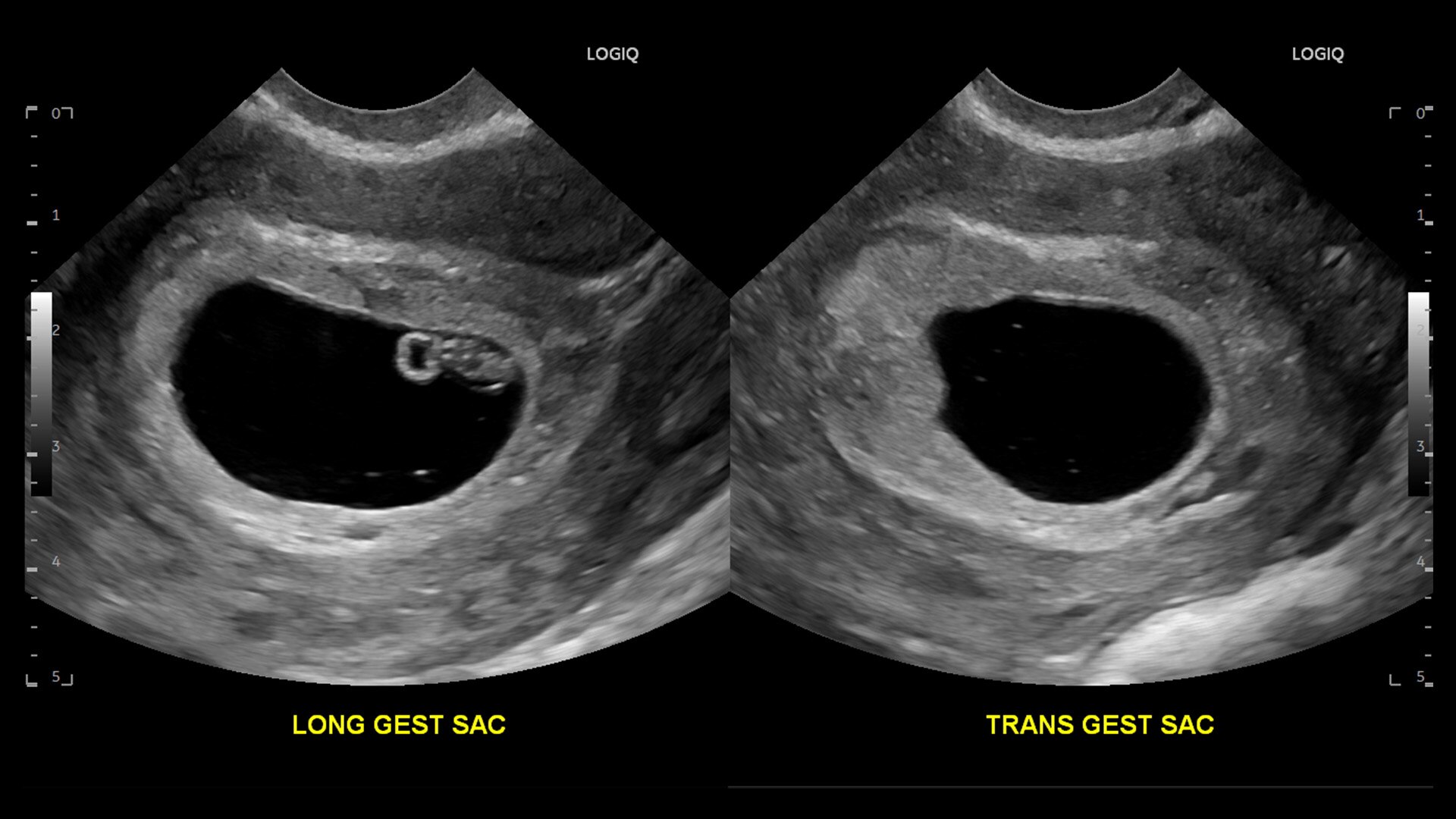 Product Media Carousel Image