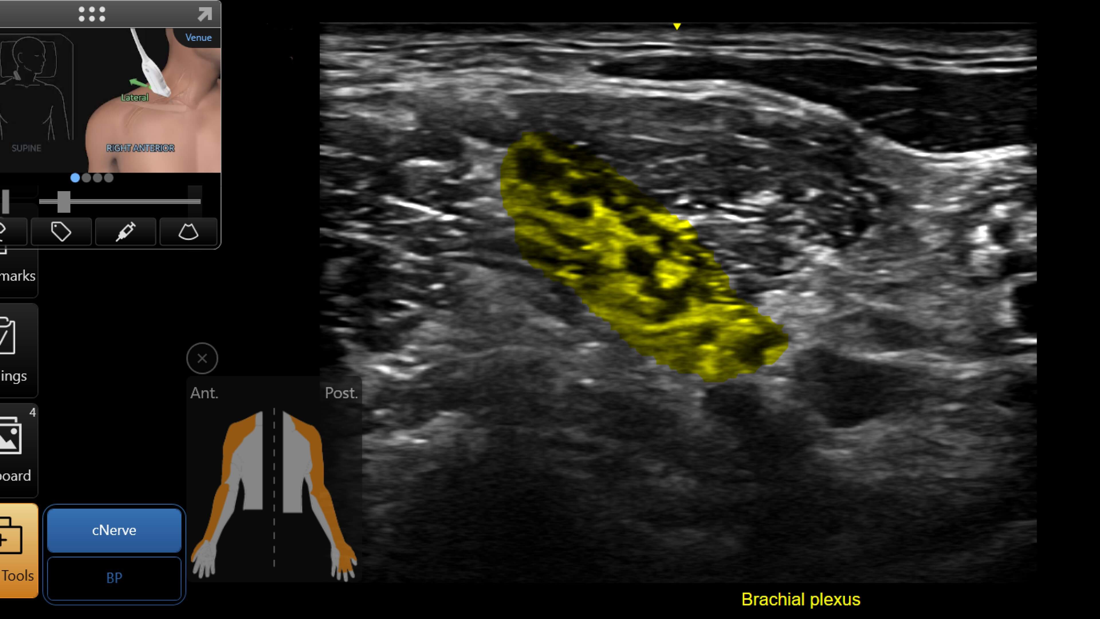 Product Media Carousel Image