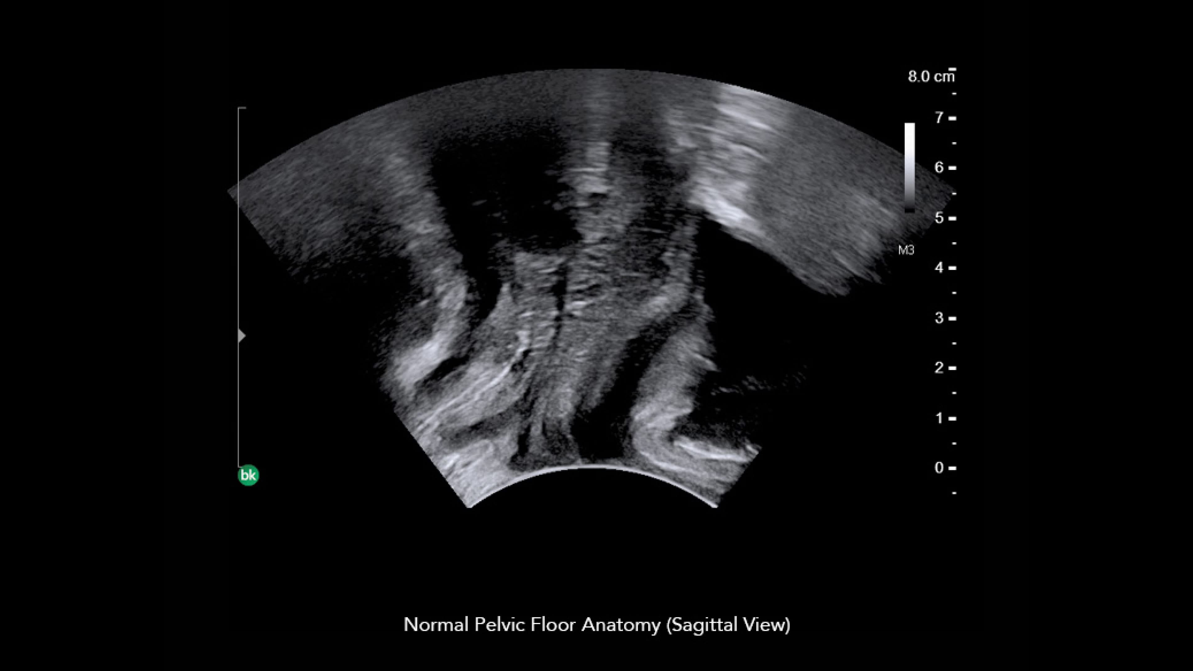 Product Media Carousel Image