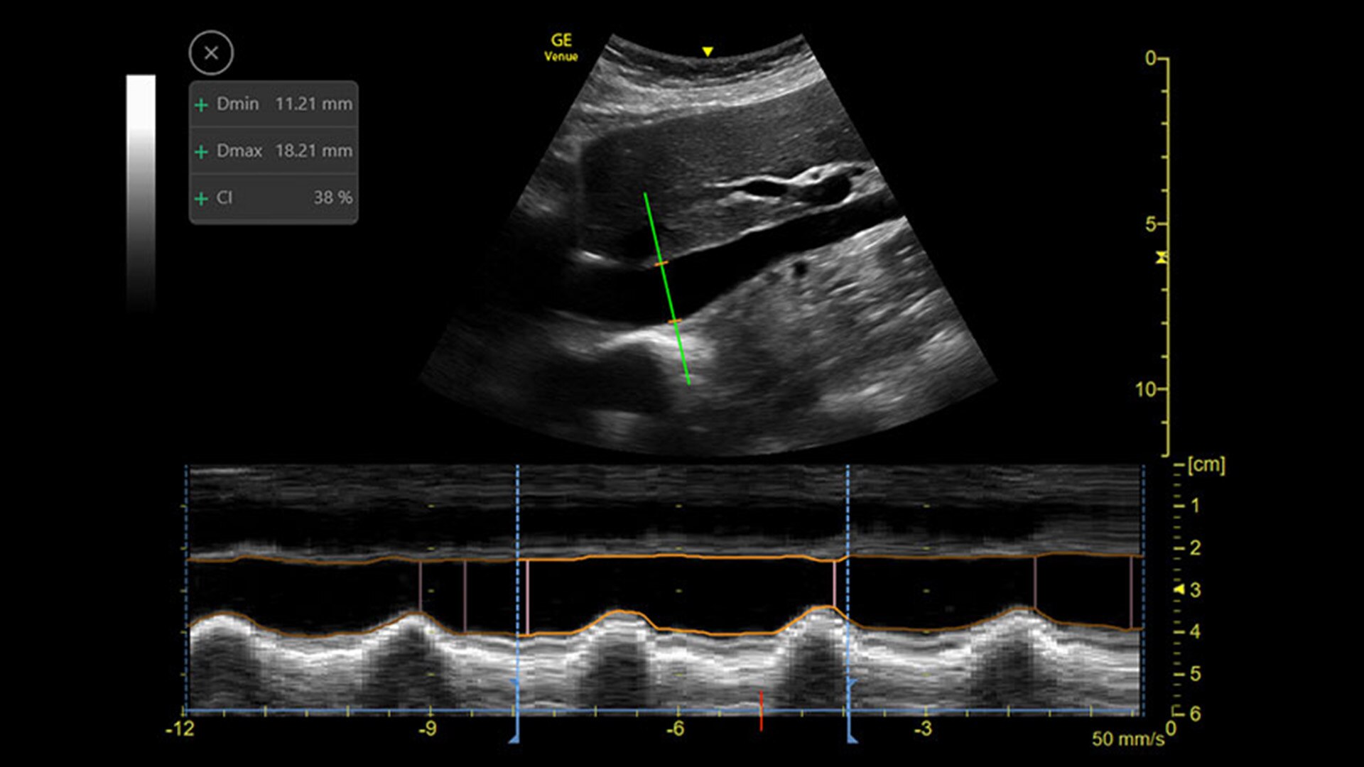Product Media Carousel Image