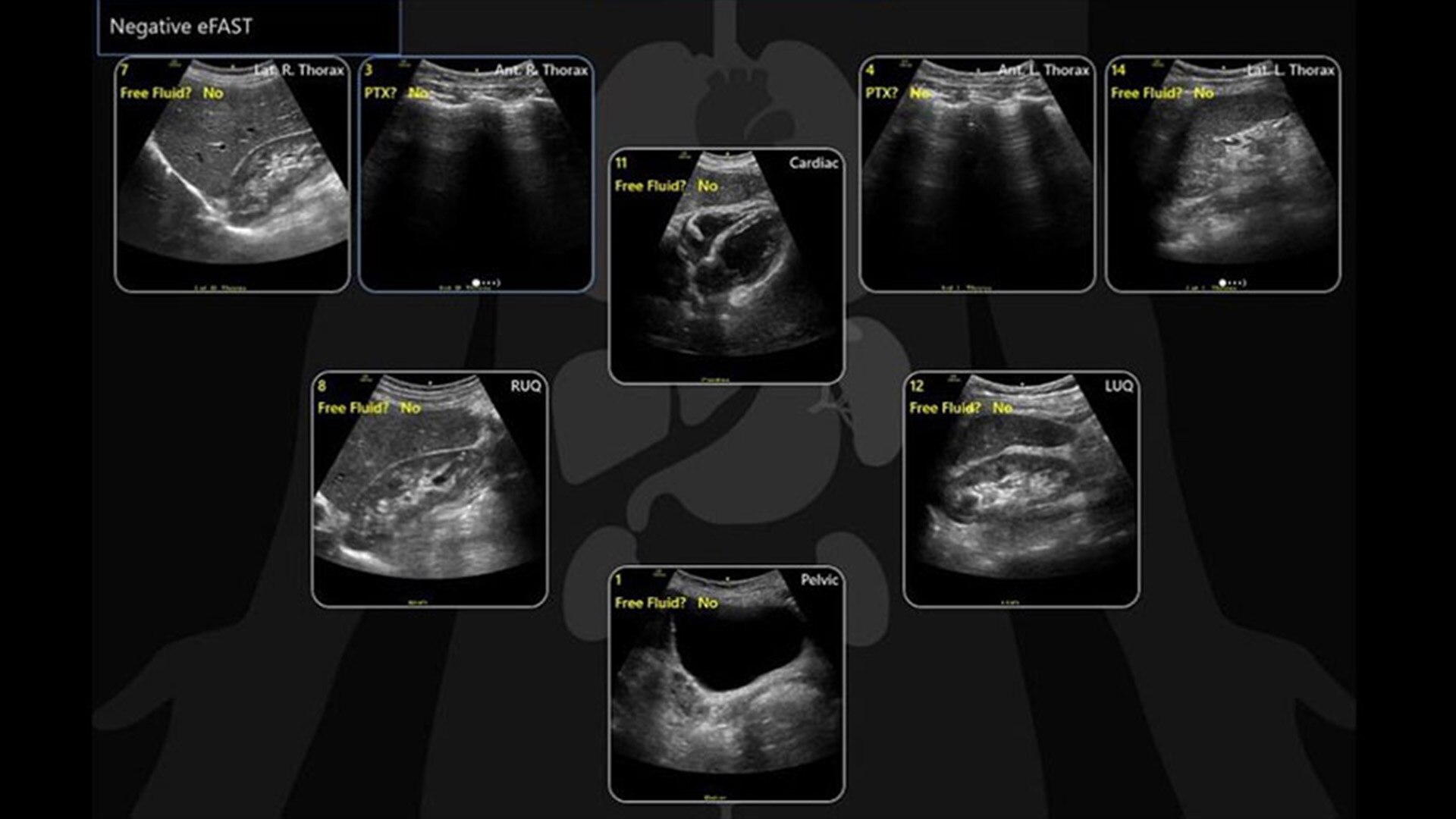 Product Media Carousel Image