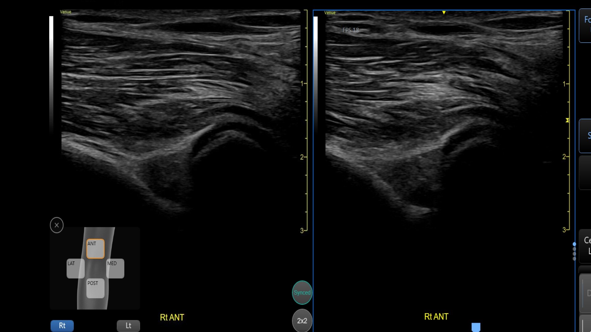 Product Media Carousel Image