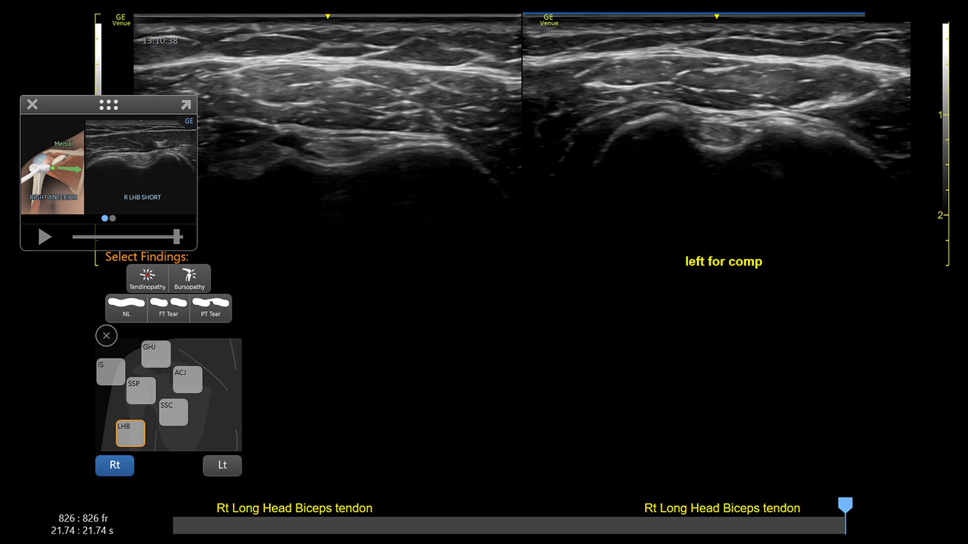 Product Media Carousel Image