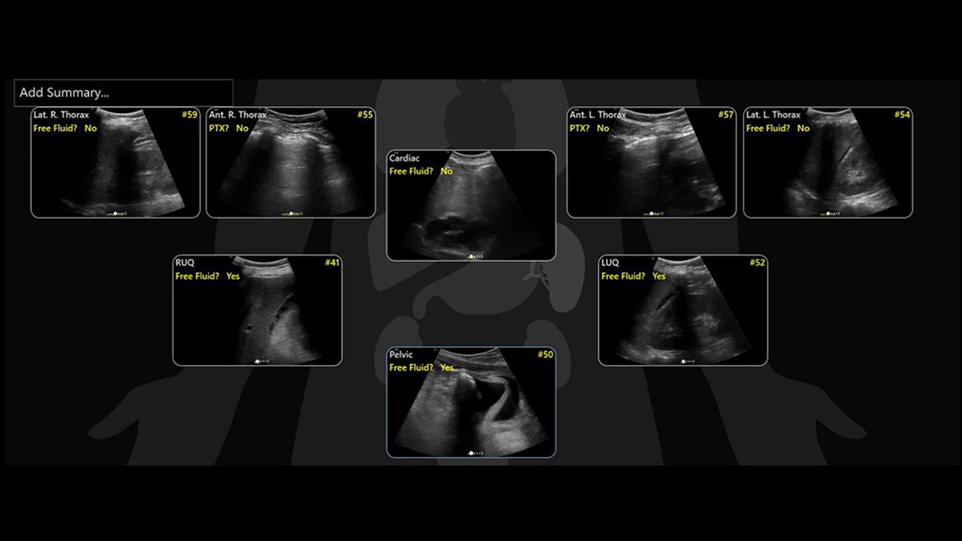 Product Media Carousel Image