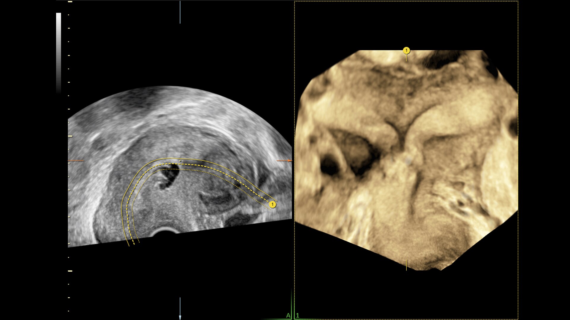 Product Media Carousel Image