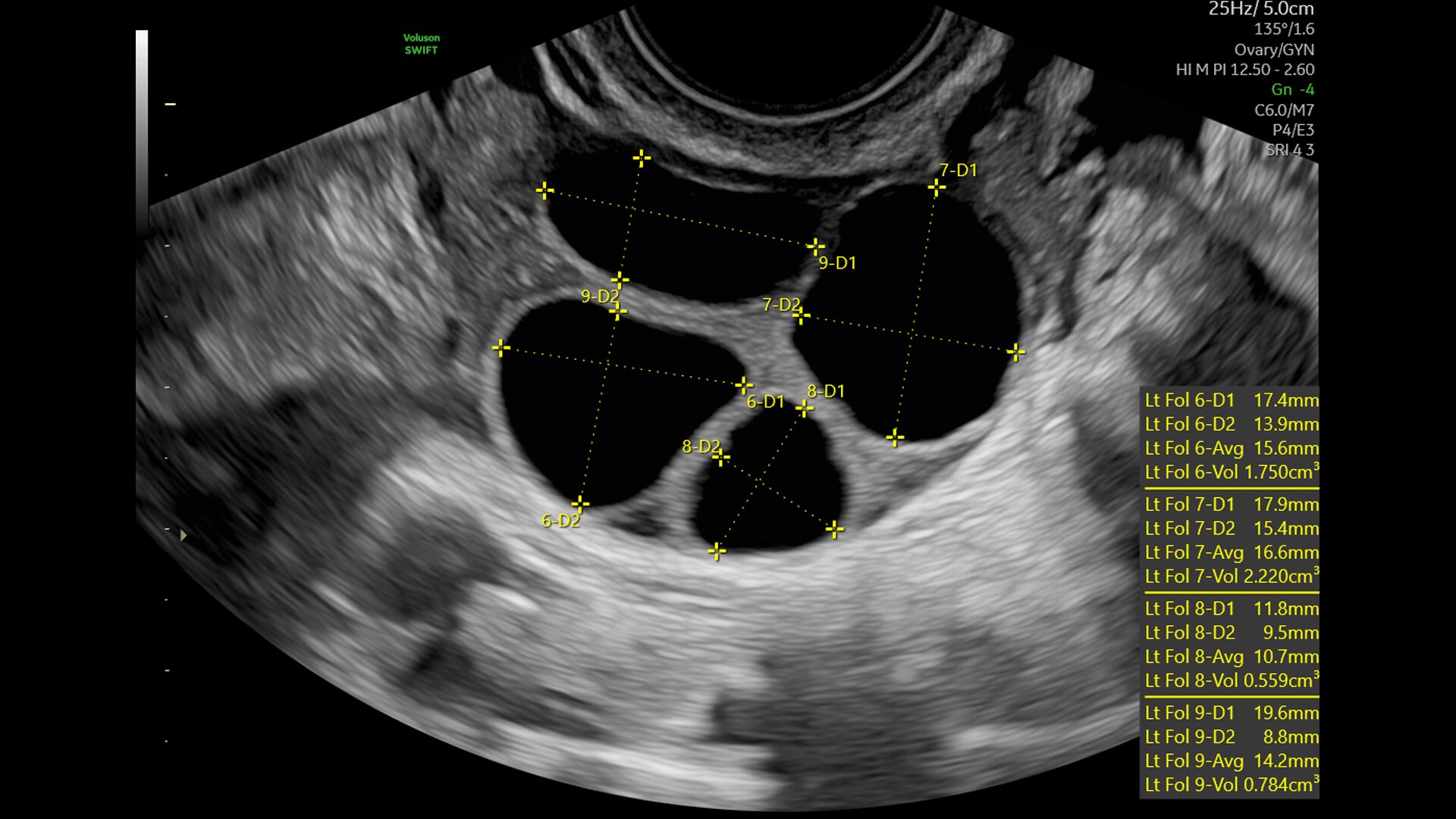 Product Media Carousel Image