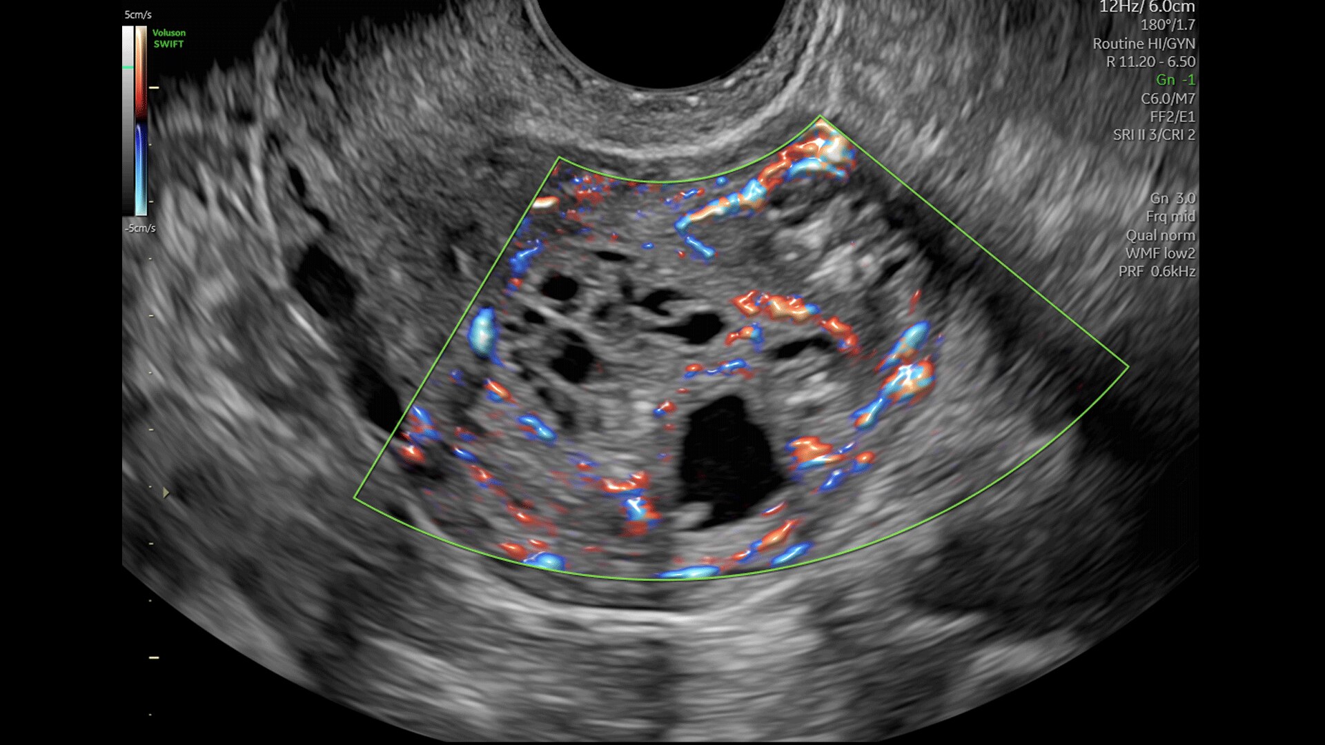 Product Media Carousel Image