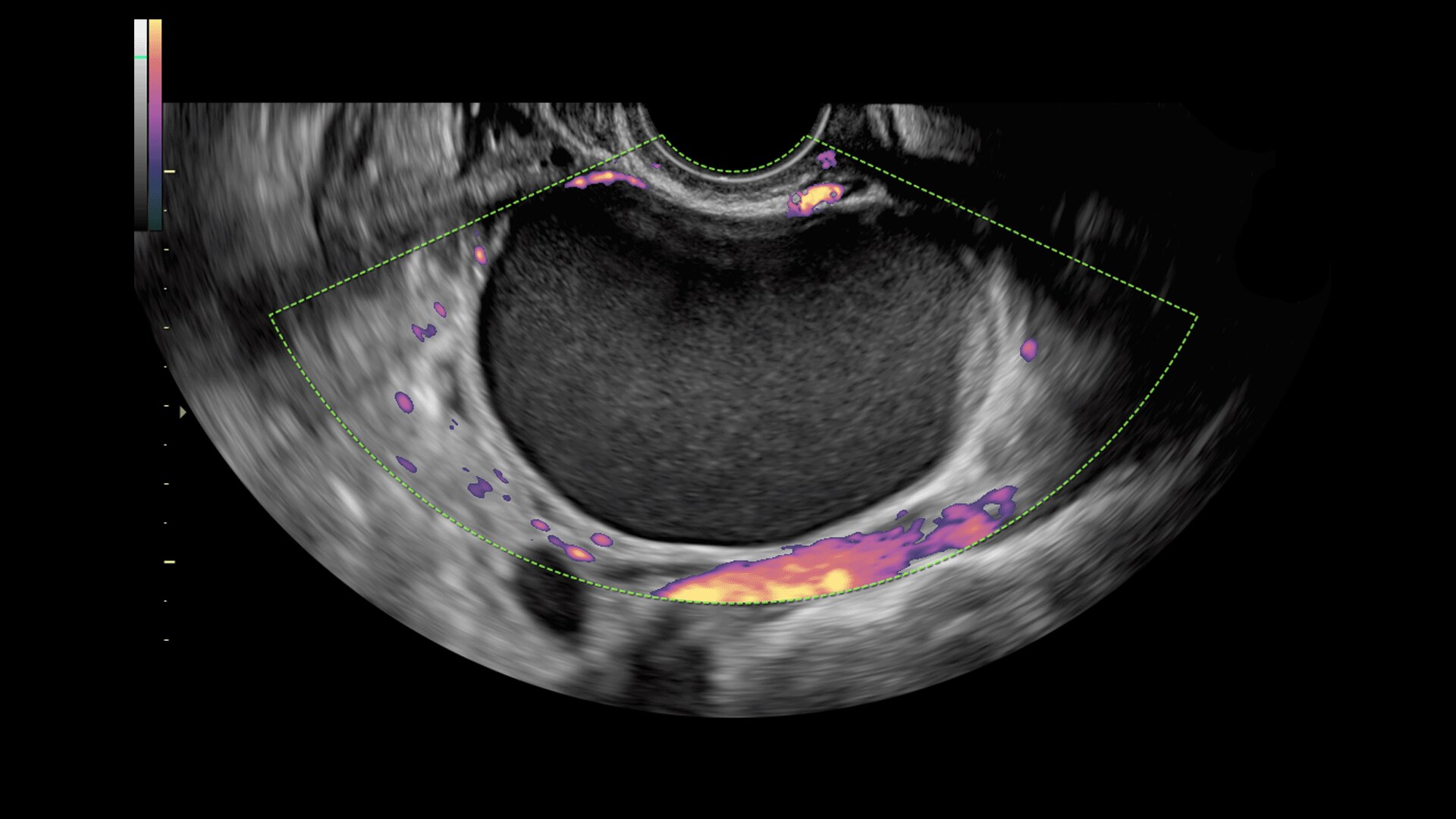 Product Media Carousel Image