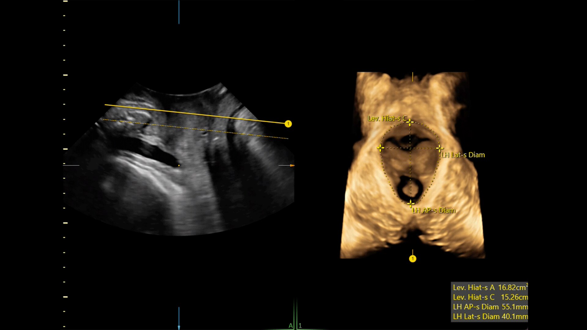 Product Media Carousel Image