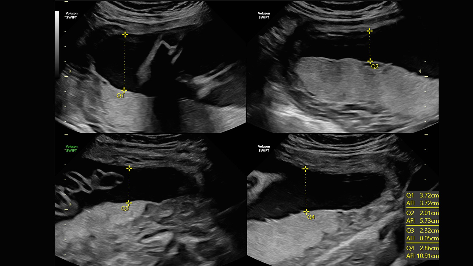 Product Media Carousel Image