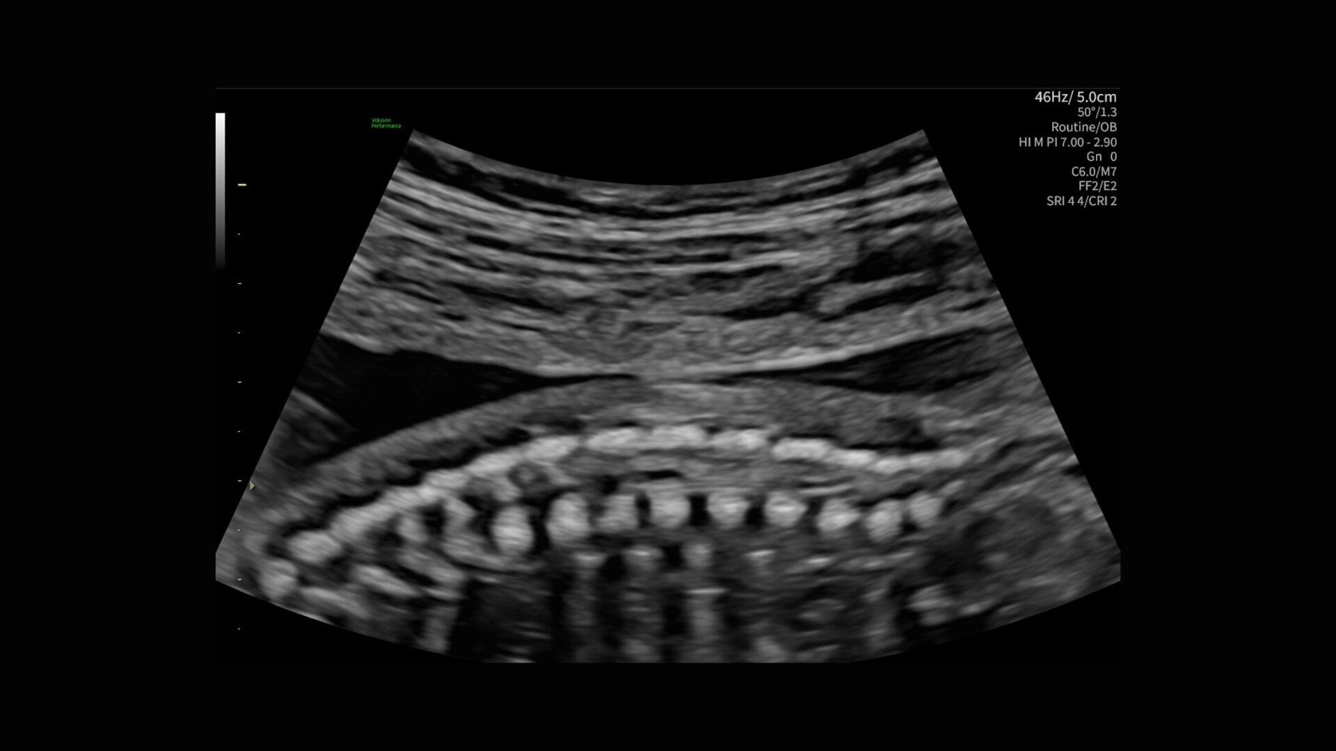 Product Media Carousel Image