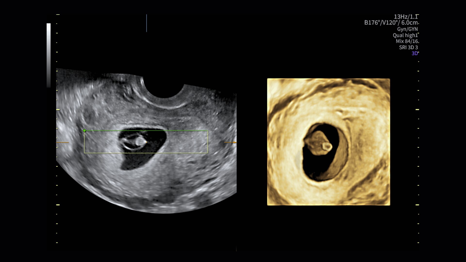 Product Media Carousel Image