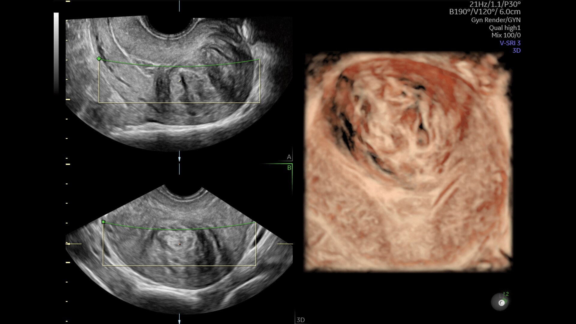 Product Media Carousel Image