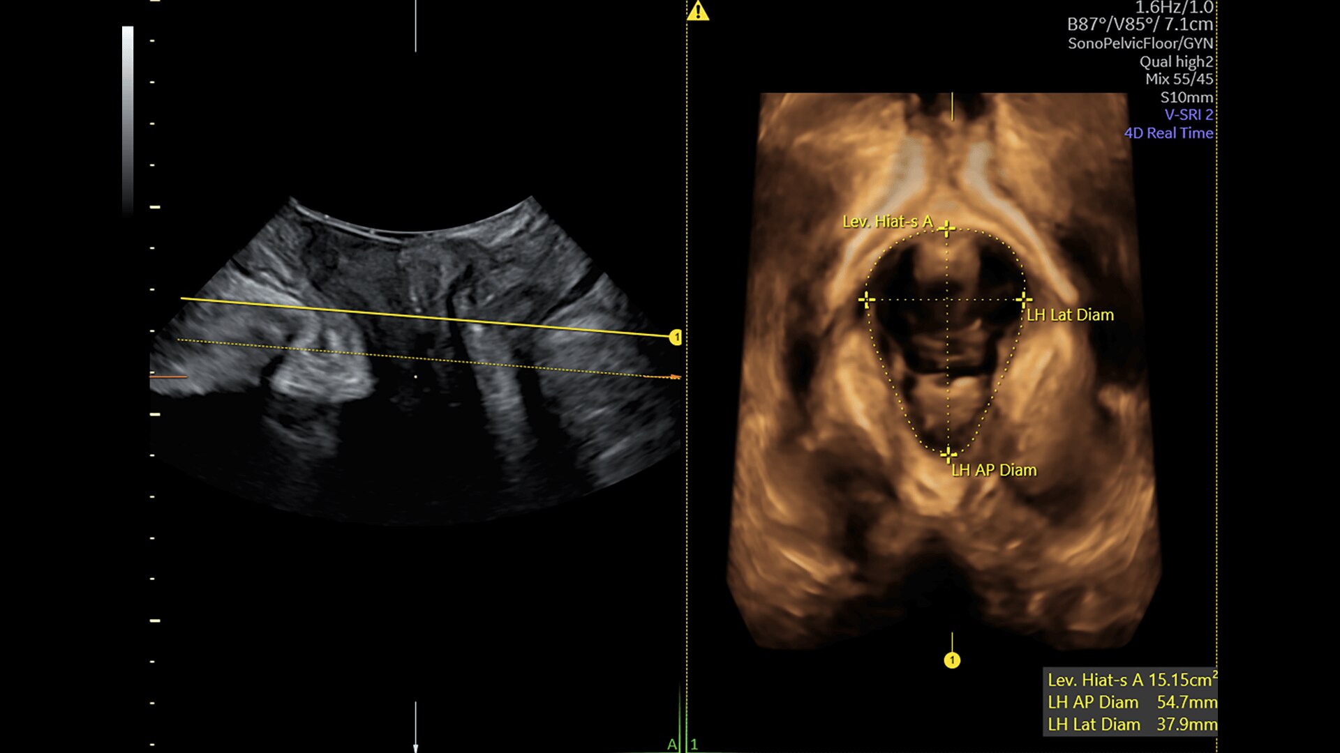 Product Media Carousel Image