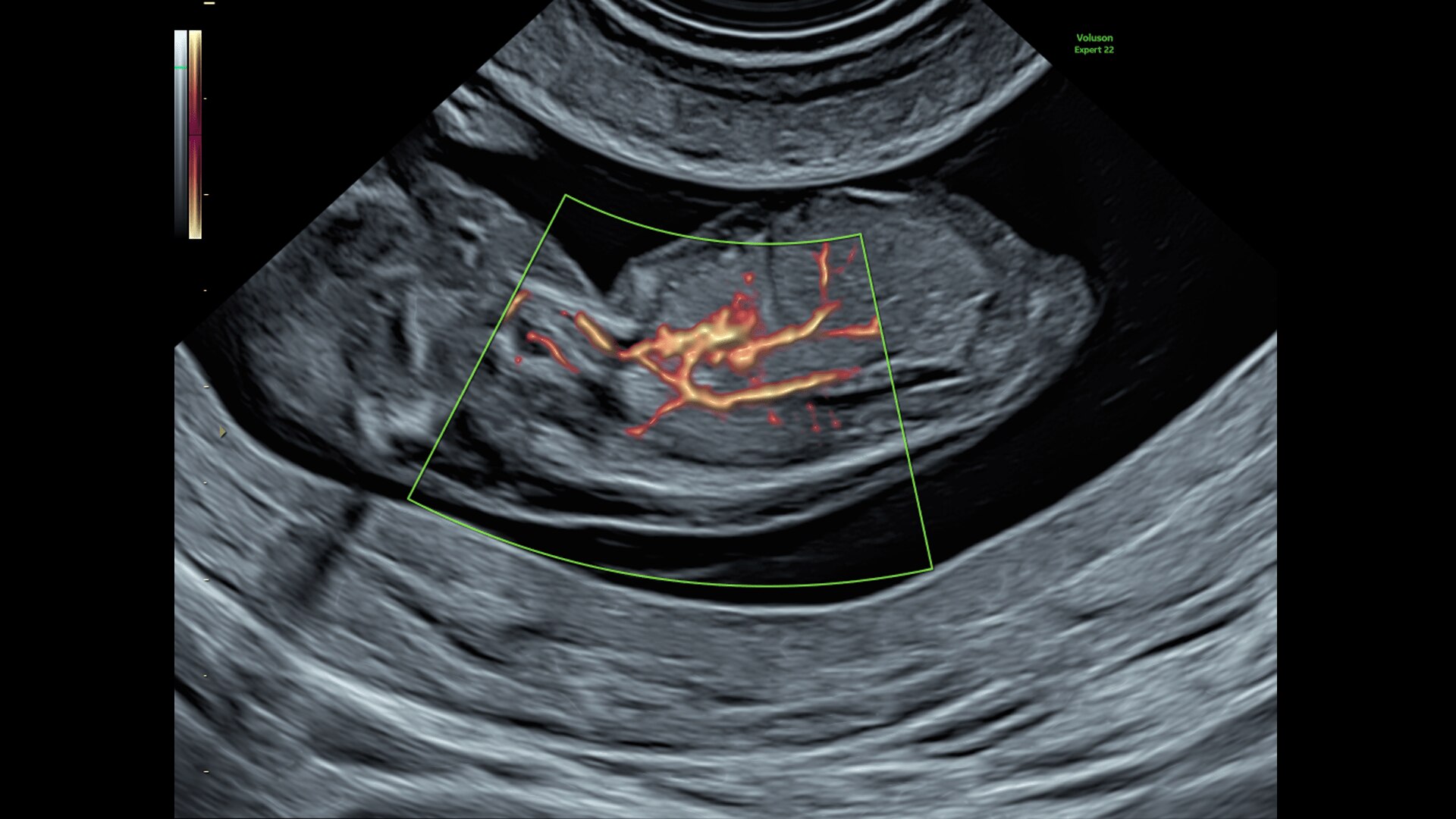 Product Media Carousel Image