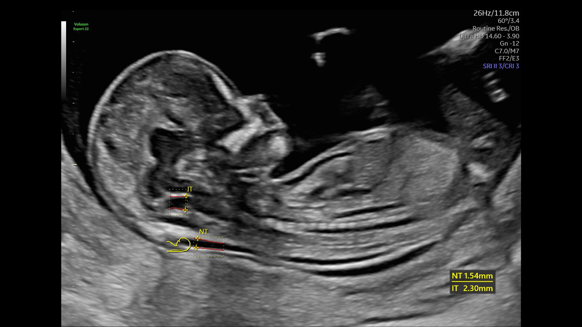 Product Media Carousel Image