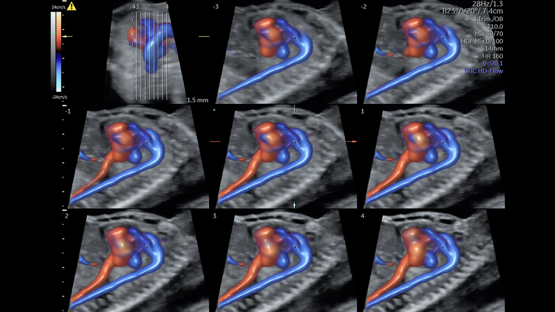 Product Media Carousel Image