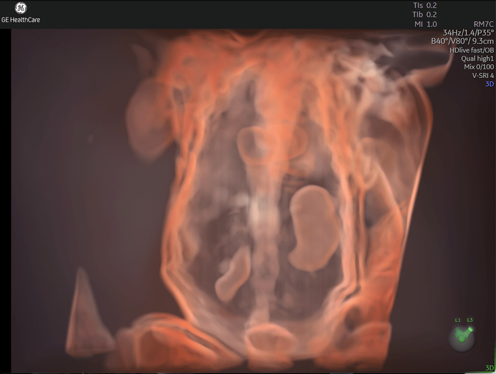 Product Media Carousel Image