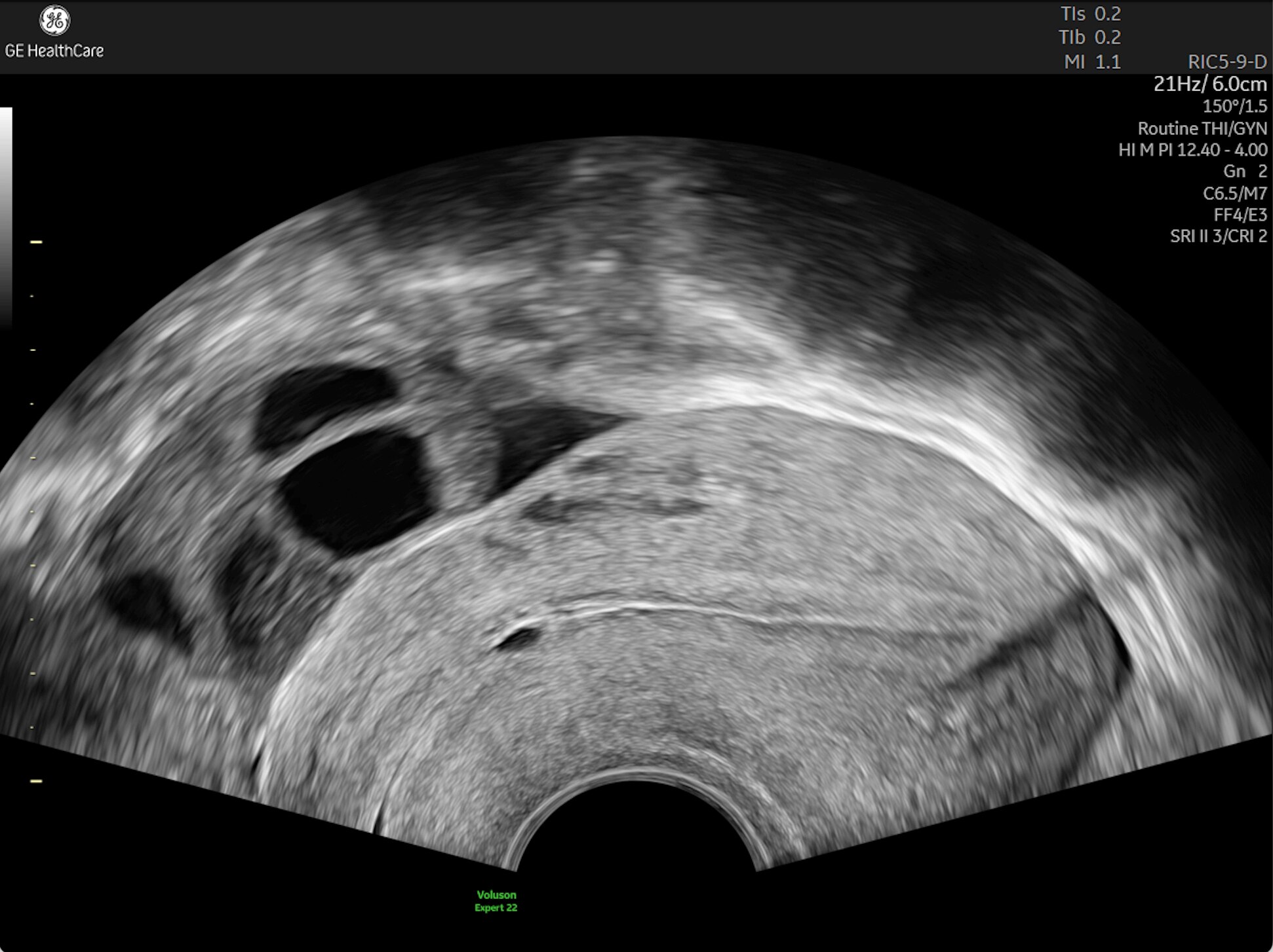 Product Media Carousel Image