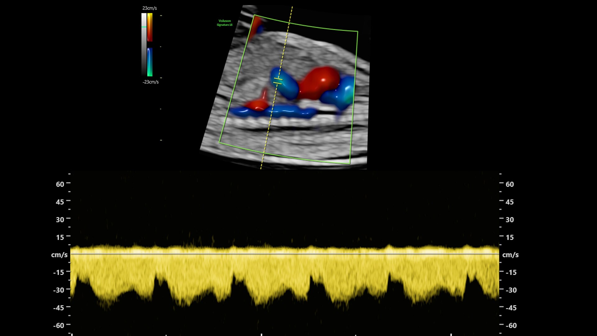 Product Media Carousel Image