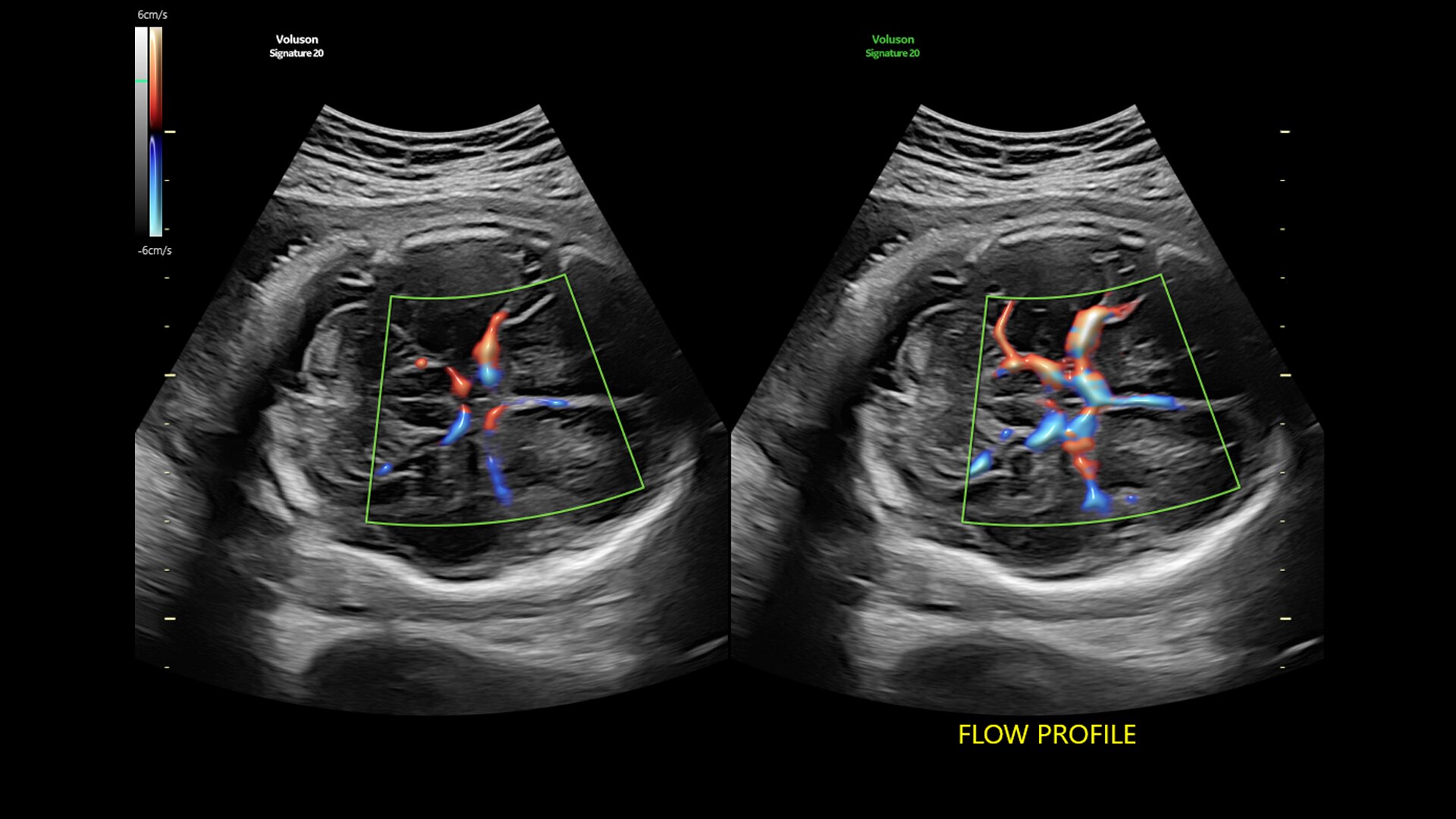Product Switcher Carousel