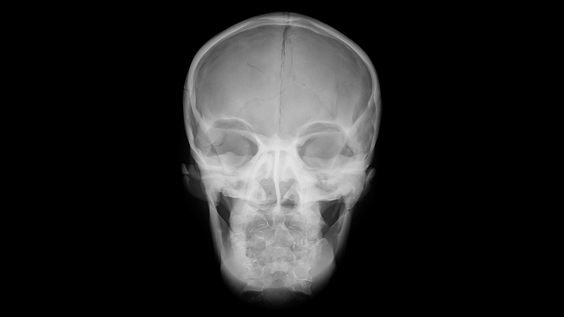 Product Media Carousel Image