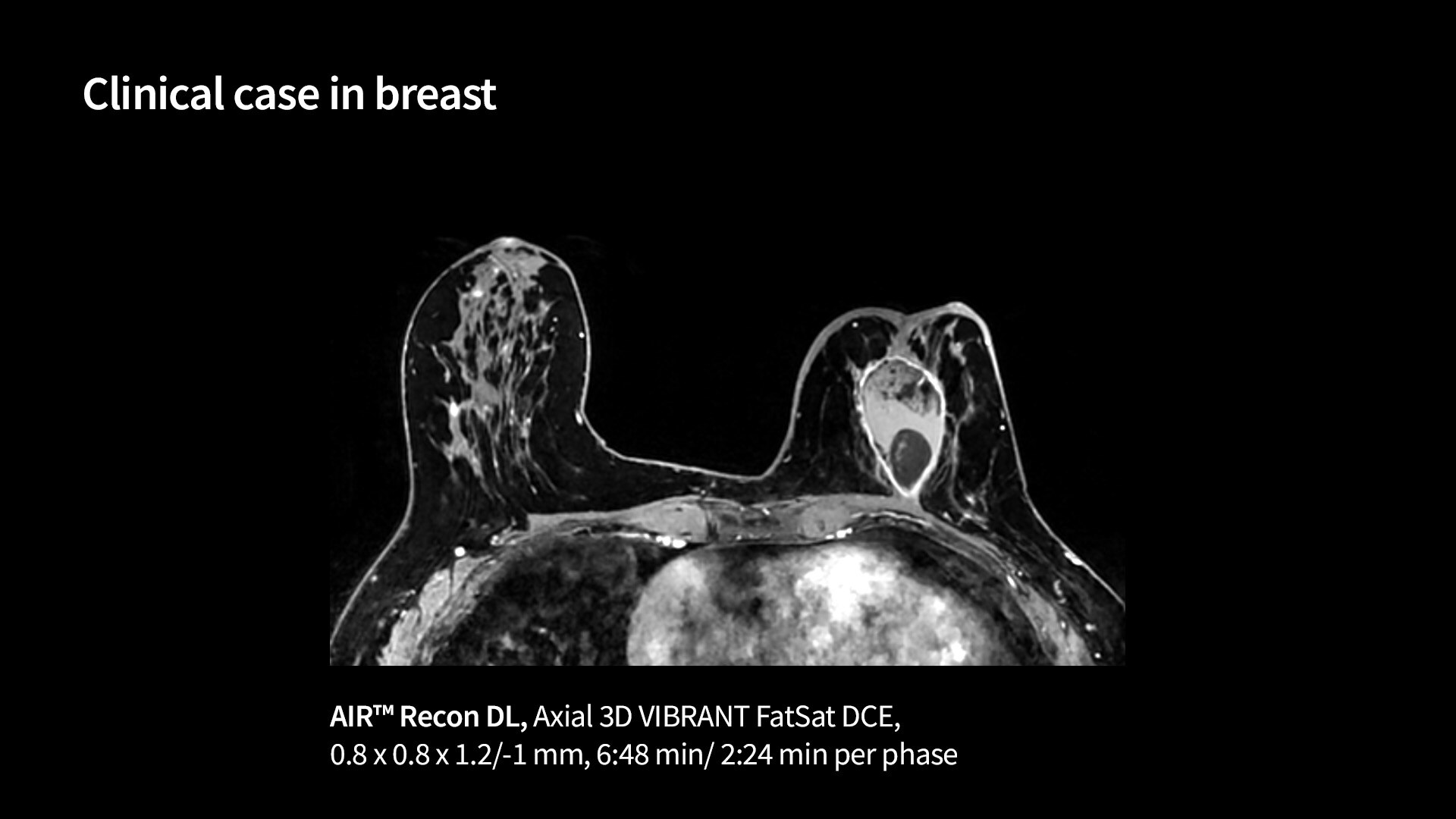 Product Media Carousel Image
