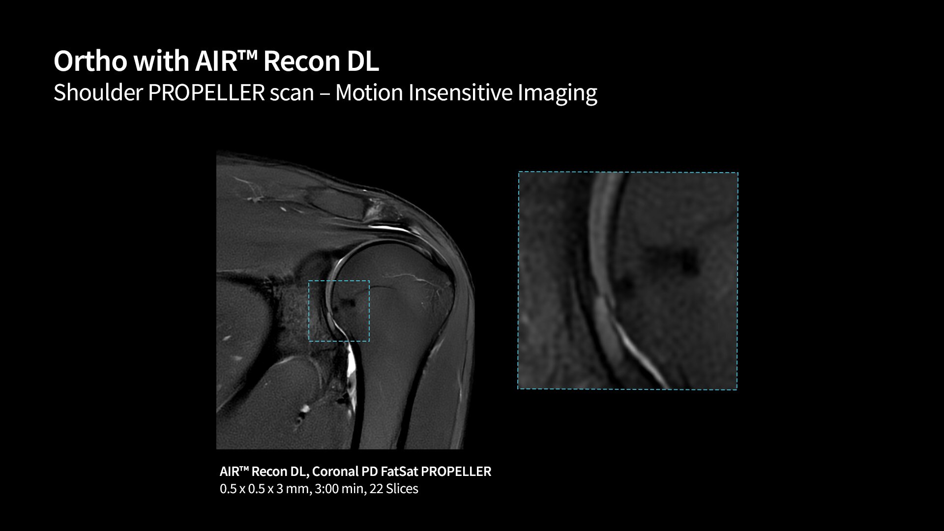 Product Media Carousel Image