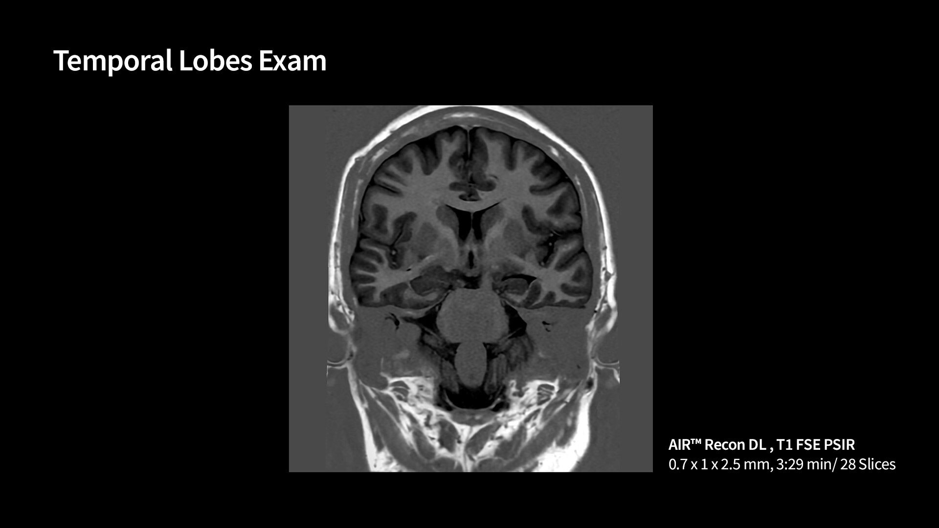 Product Media Carousel Image