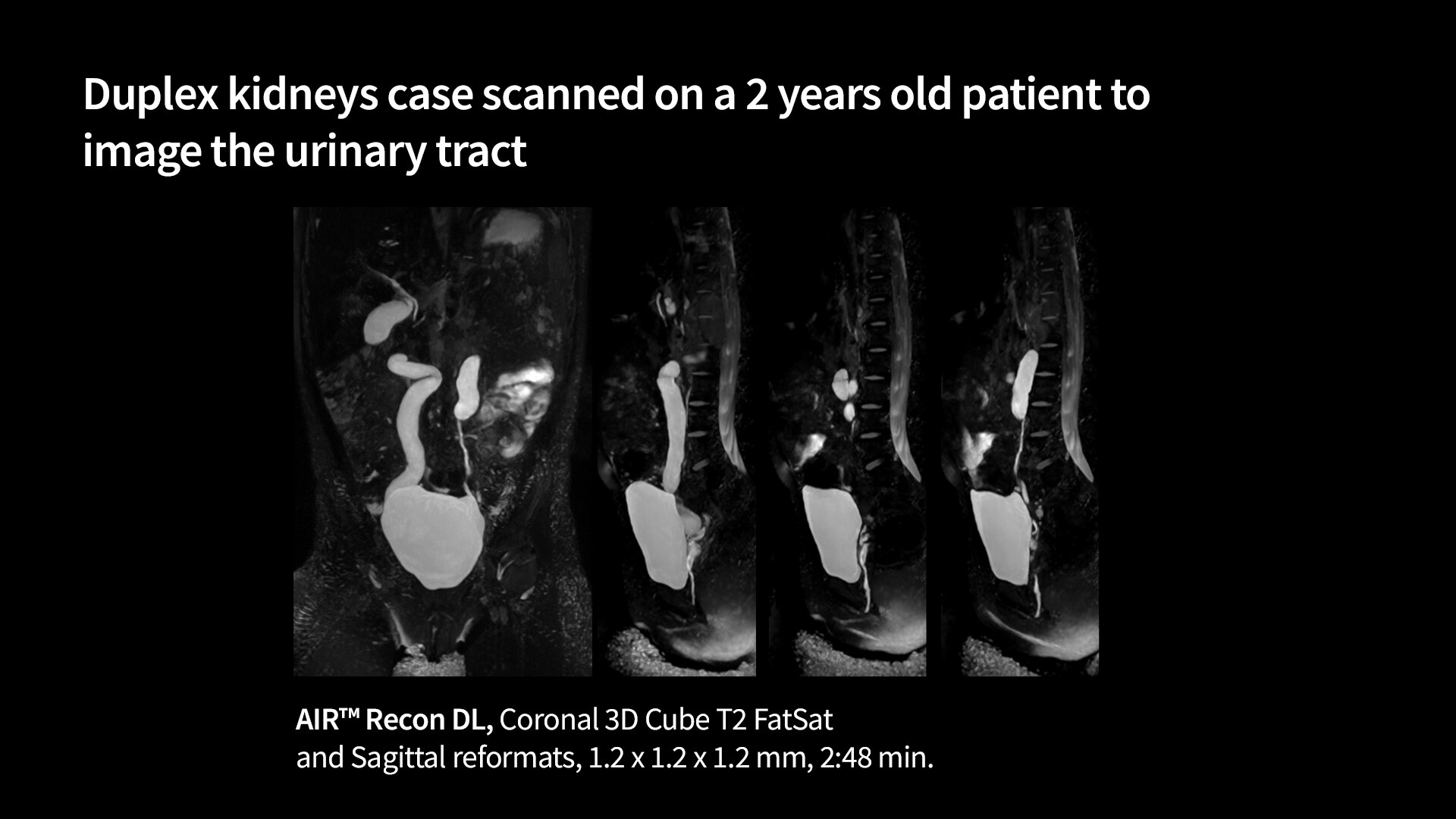 Product Media Carousel Image
