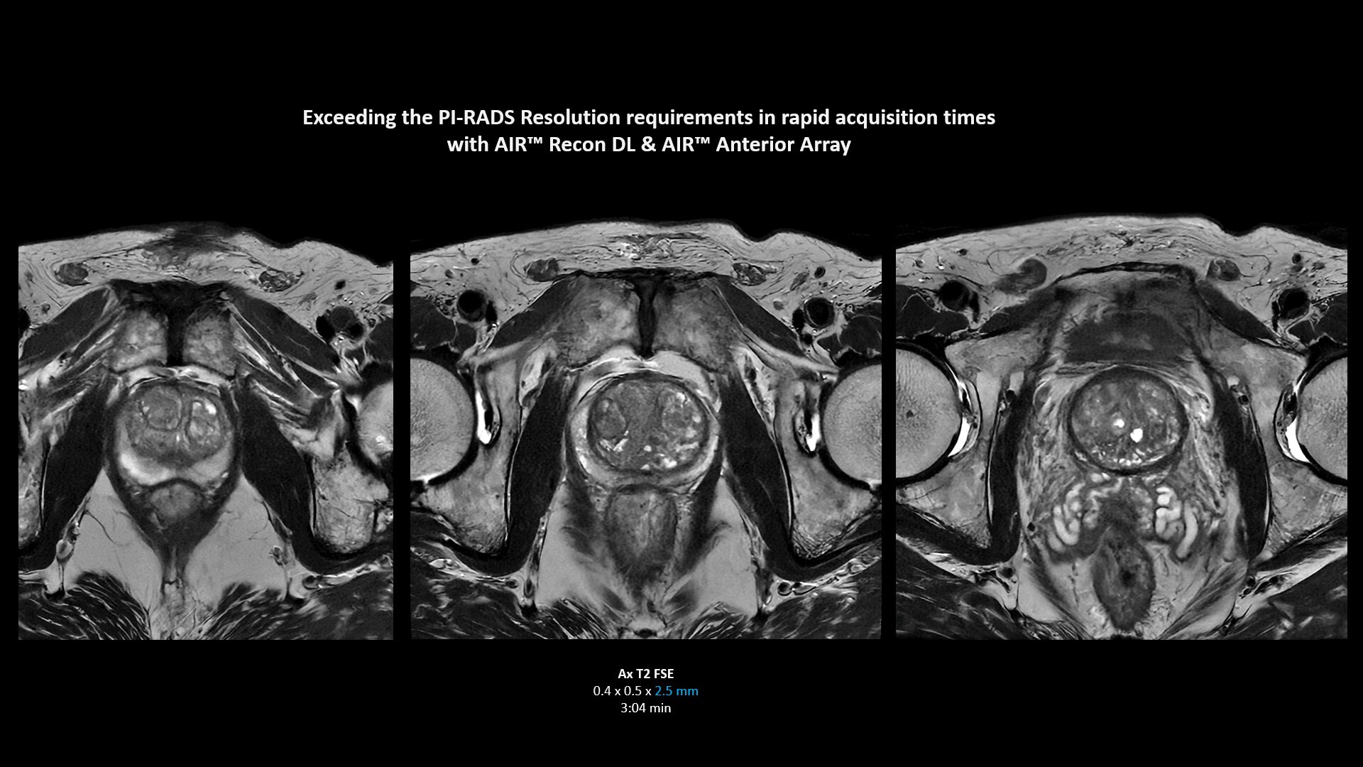 Product Media Carousel Image