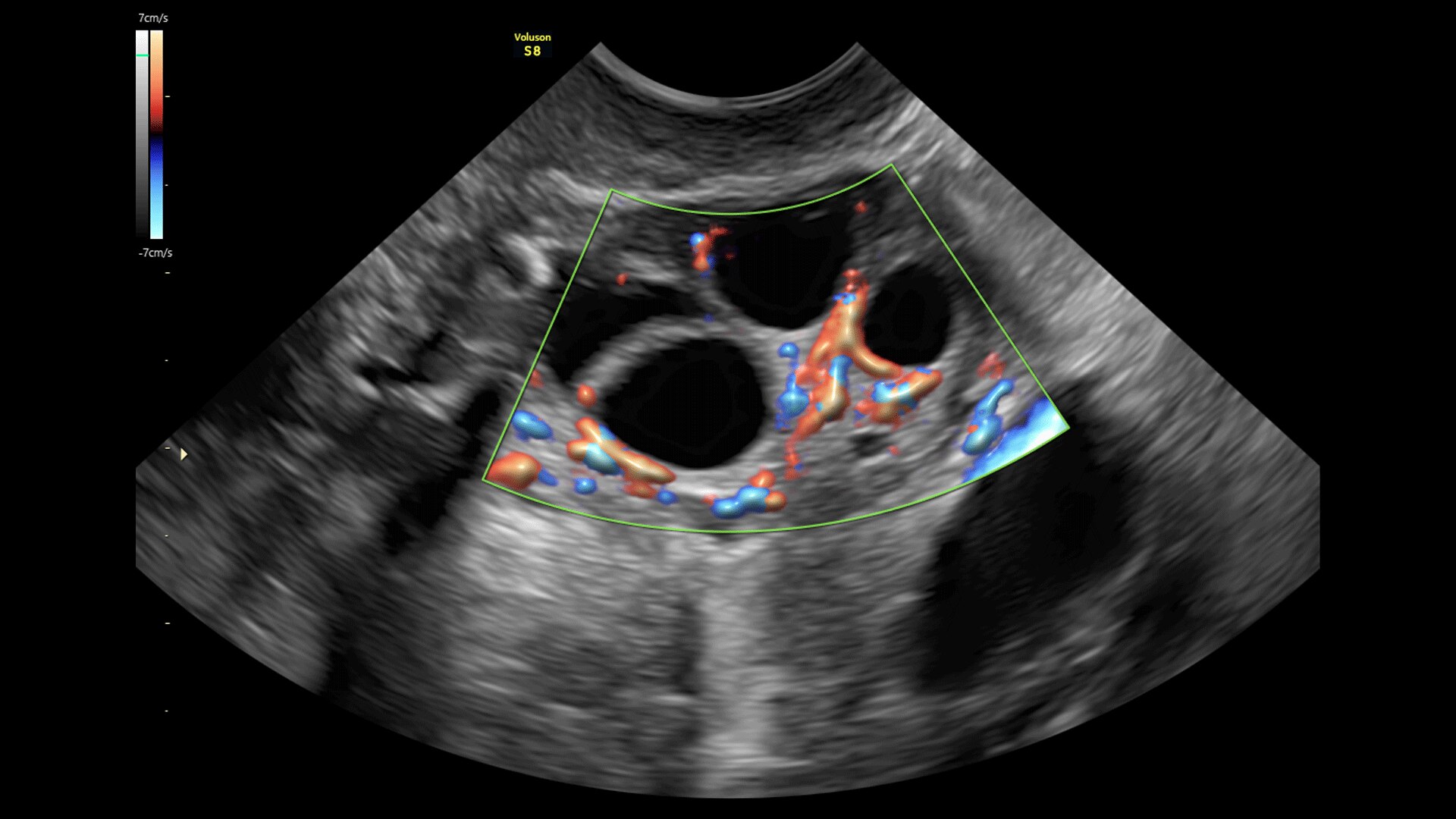 Product Media Carousel Image