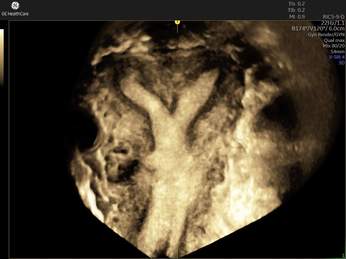 Product Media Carousel Image